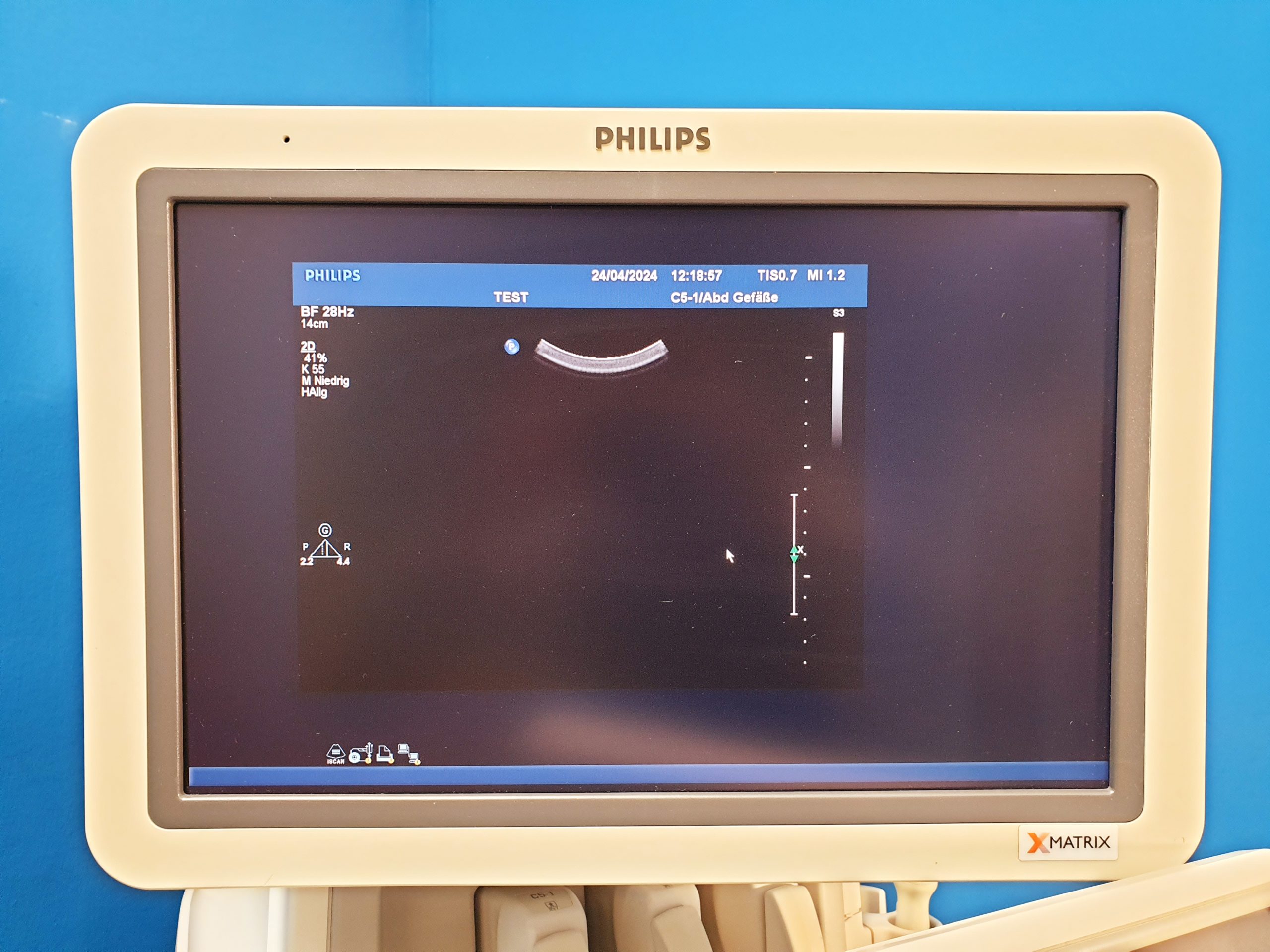 Philips Kardiomaschine IE33 + C5-1 + L9-3 + S5-1 DOM 2011 Vollausgestattet thumbnail 6