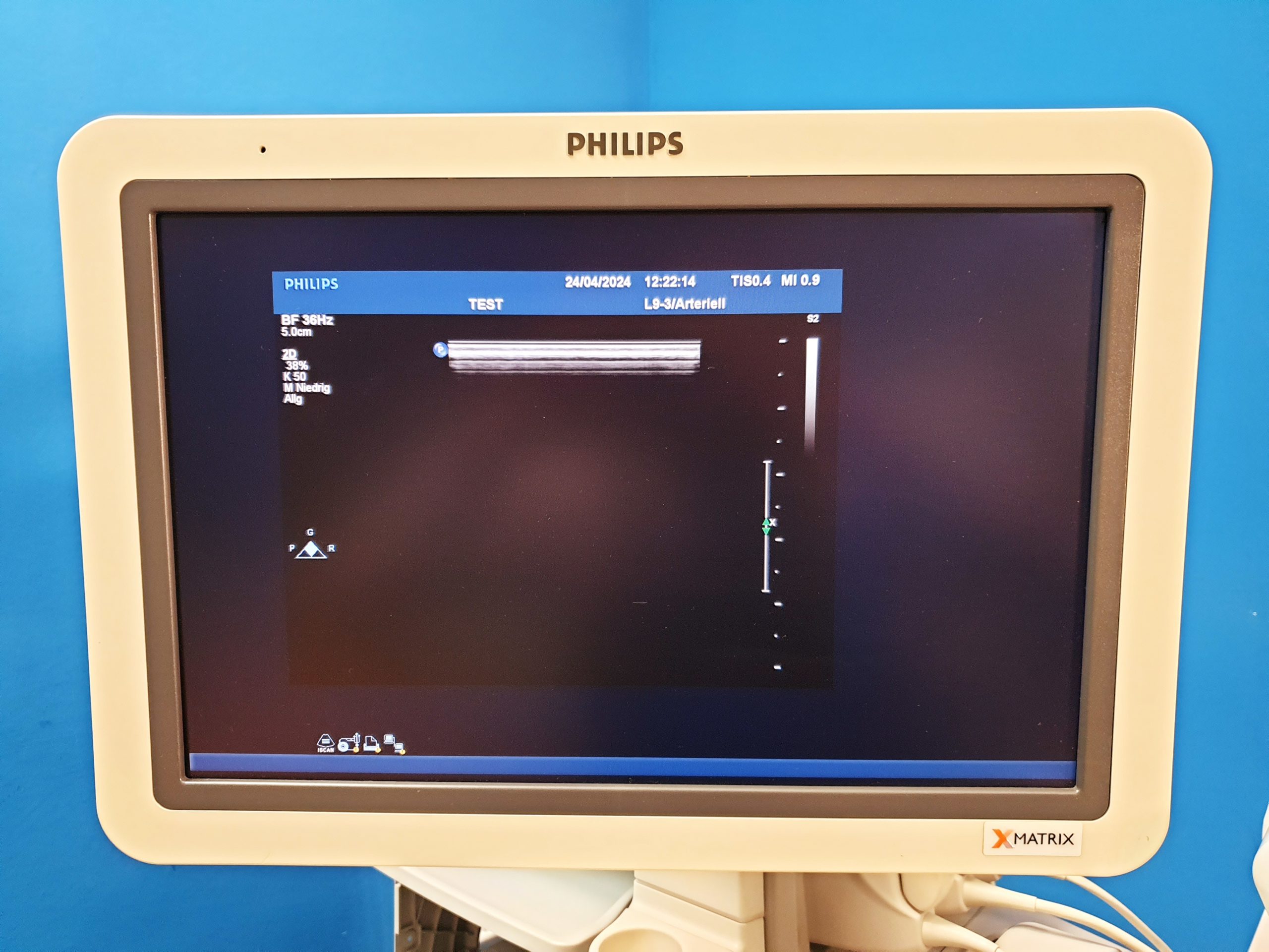 Philips Kardiomaschine IE33 + C5-1 + L9-3 + S5-1 DOM 2011 Vollausgestattet thumbnail 10
