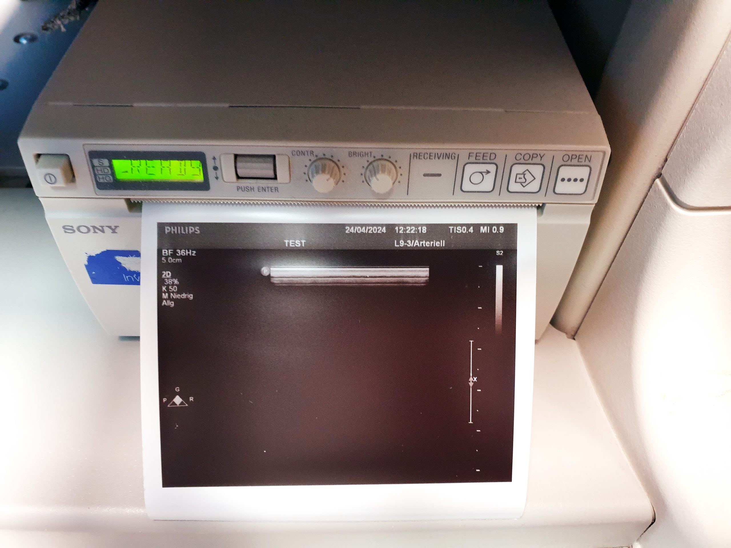 Philips Kardiomaschine IE33 + C5-1 + L9-3 + S5-1 DOM 2011 Vollausgestattet thumbnail 11