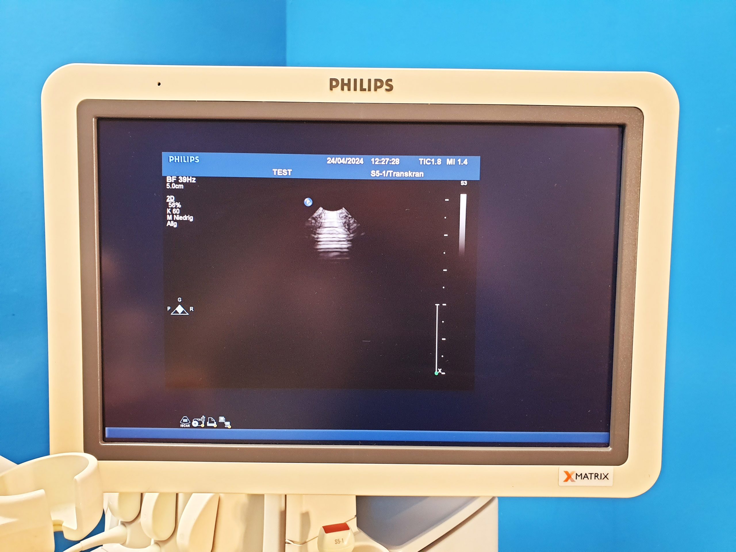 Philips Kardiomaschine IE33 + C5-1 + L9-3 + S5-1 DOM 2011 Vollausgestattet thumbnail 14