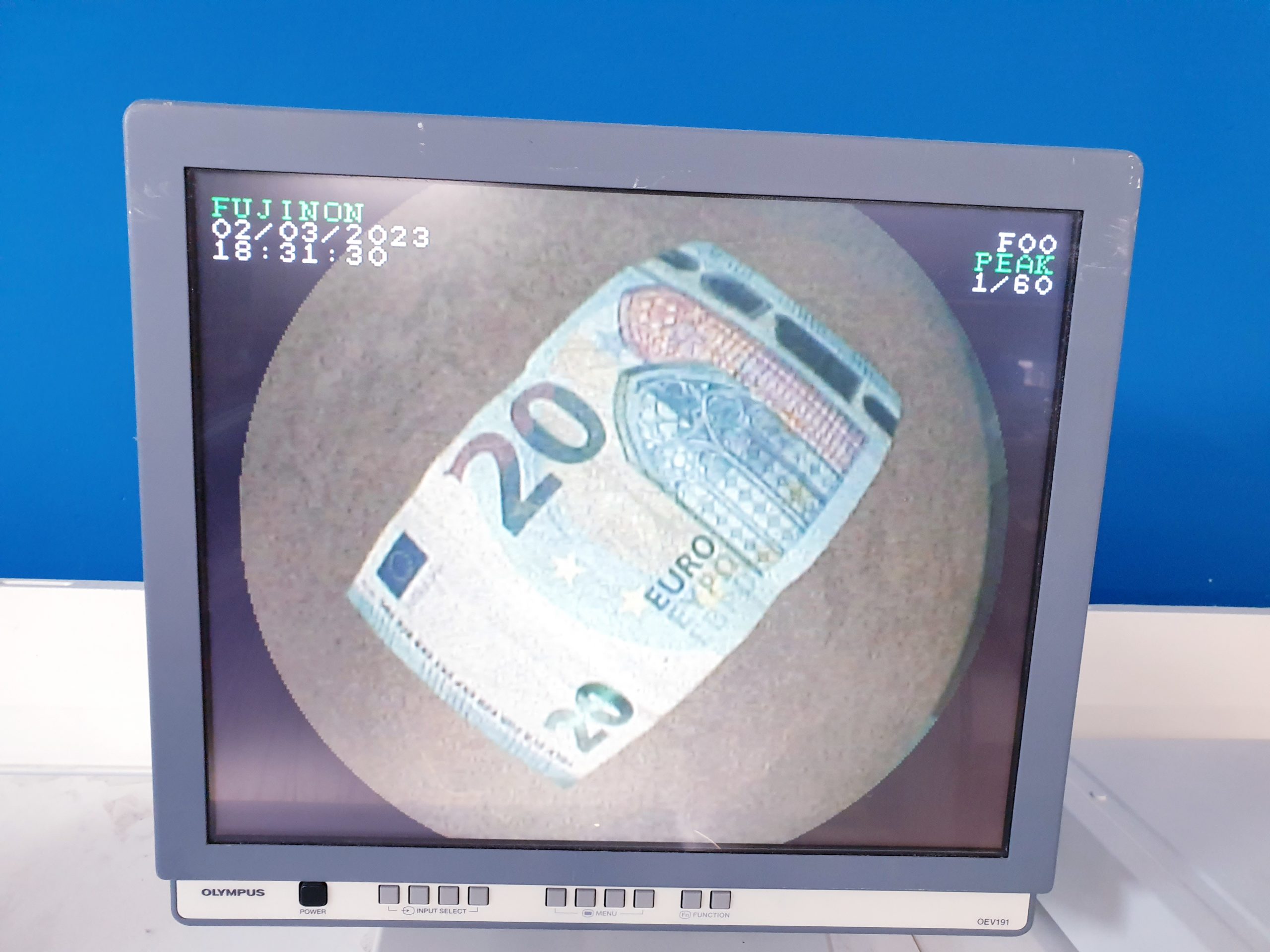 Fujinon EG-530 UR2 Radialscan Ultraschall Endoskop — image 1 of 14