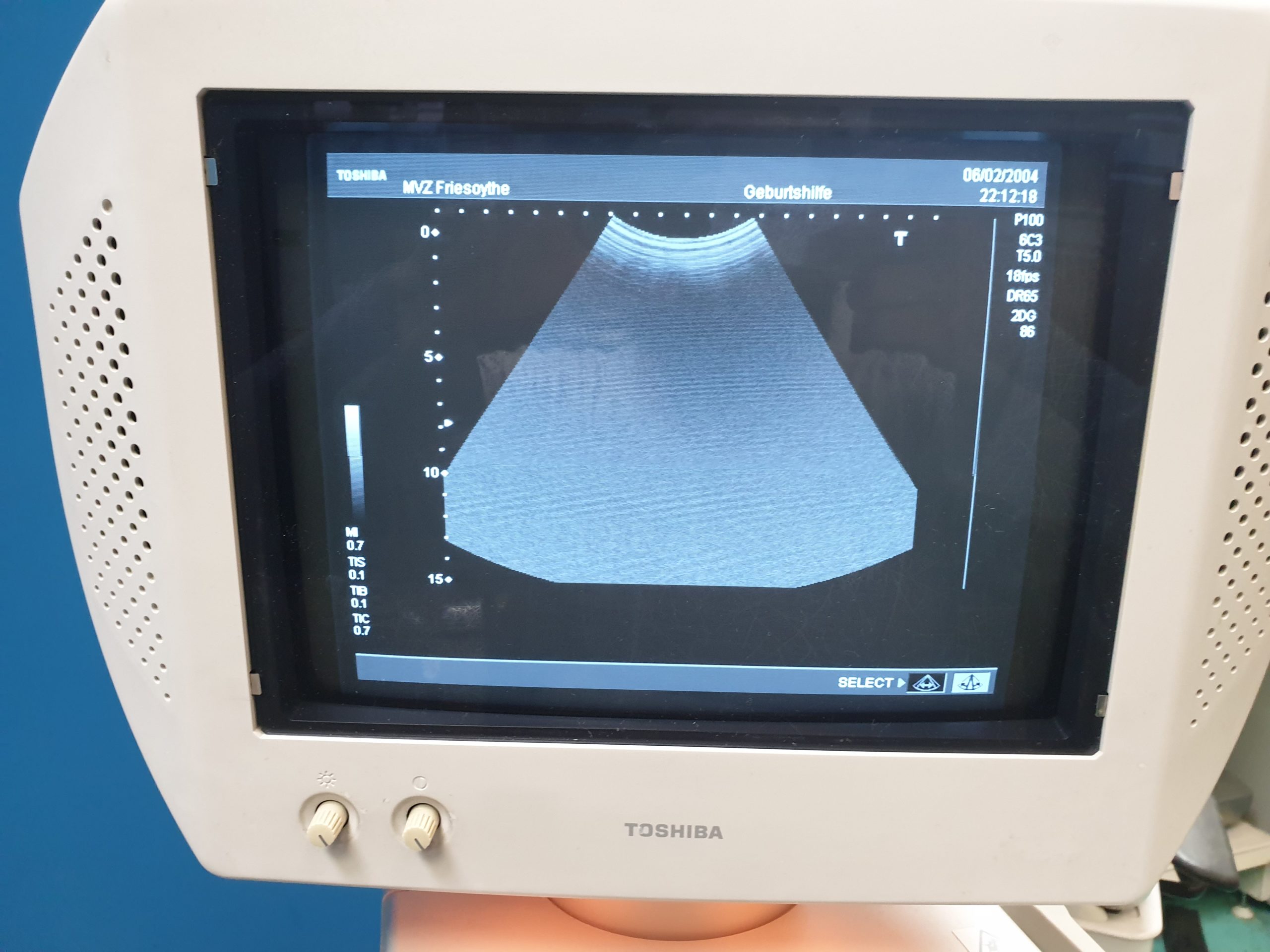 Toshiba PVM- 375AT Convex Ultraschallsonde Transducer thumbnail 2