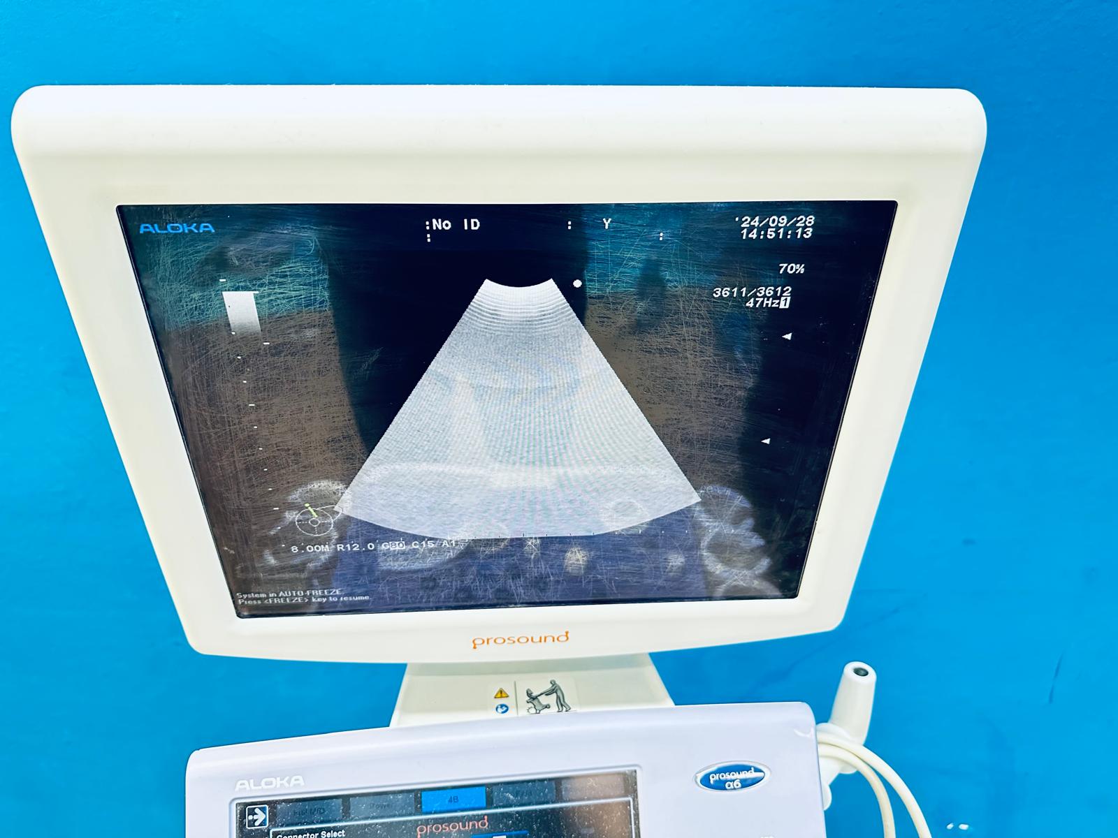 ALOKA UST-995-7.5 Ultraschallsonde thumbnail 8