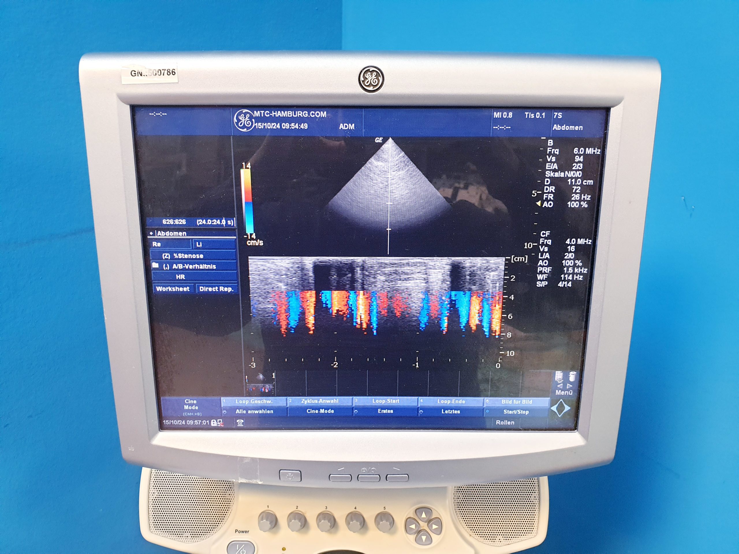 GE Logiq P5 + 11L Linear + 7S Kardio – Echo Farbdoppler Dom 2012 thumbnail 4