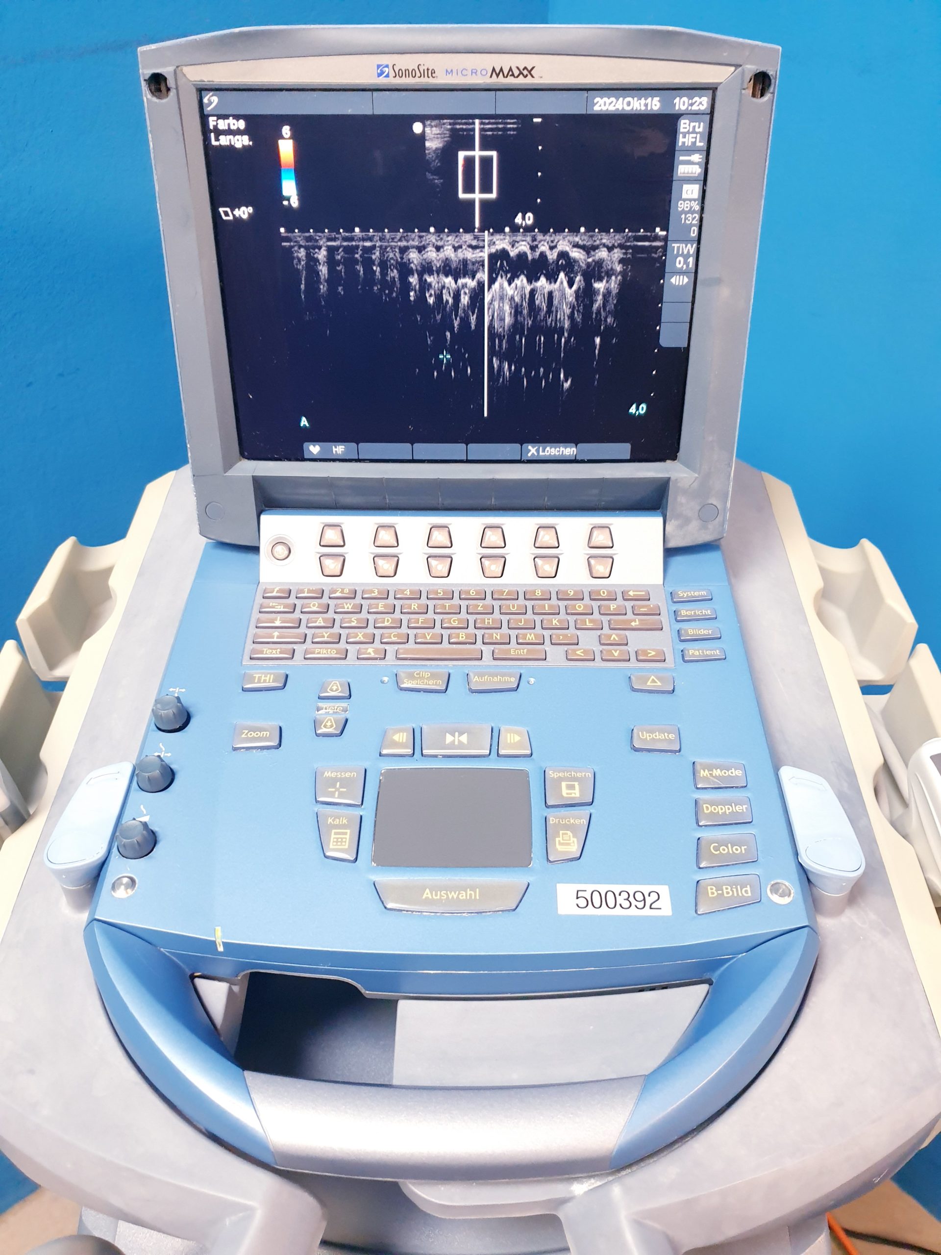 SonoSite MicroMaxx + Linear + Konvex – DOM 2009 thumbnail 3