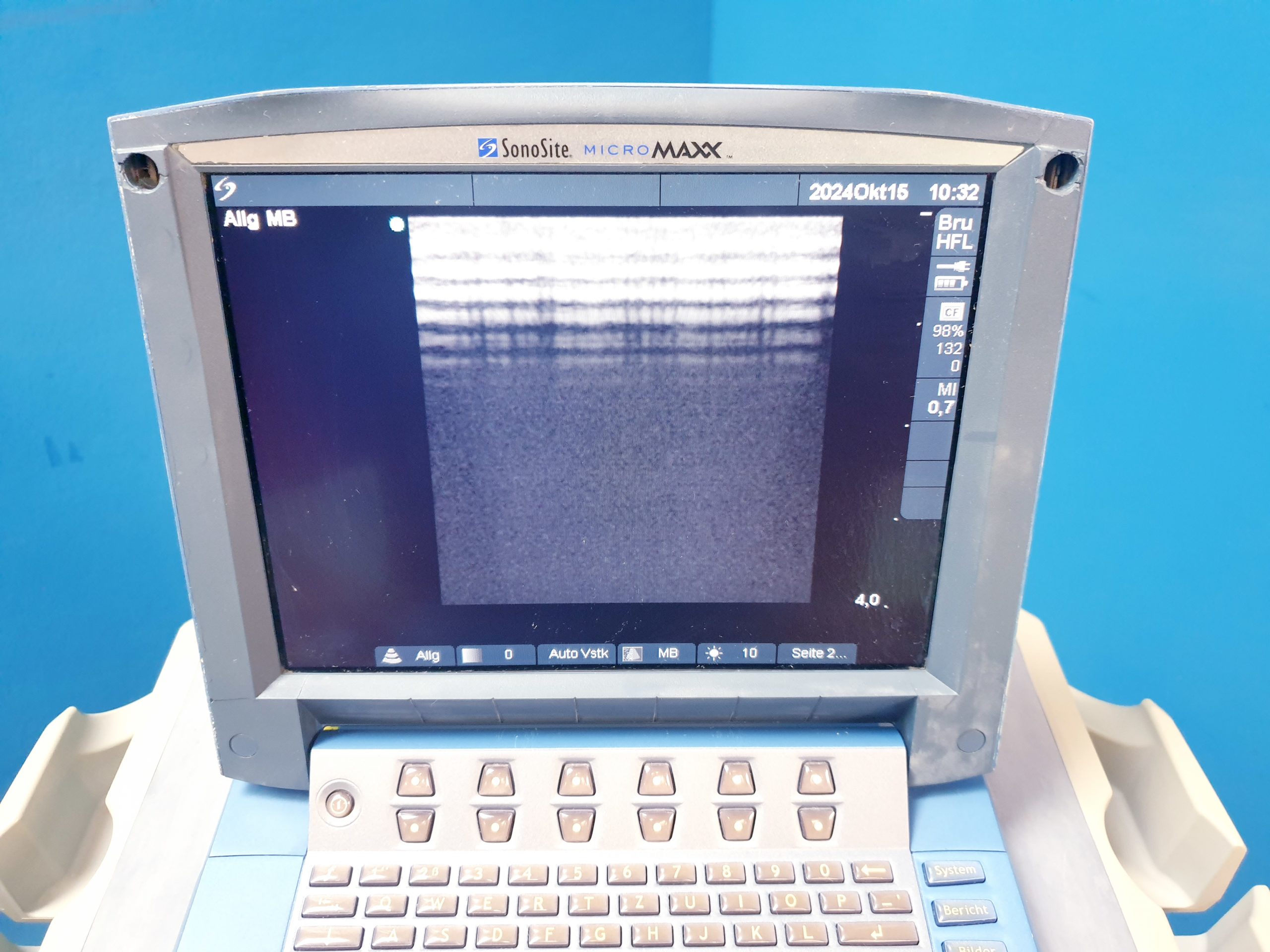 SonoSite MicroMaxx + Linear + Konvex – DOM 2009 thumbnail 6