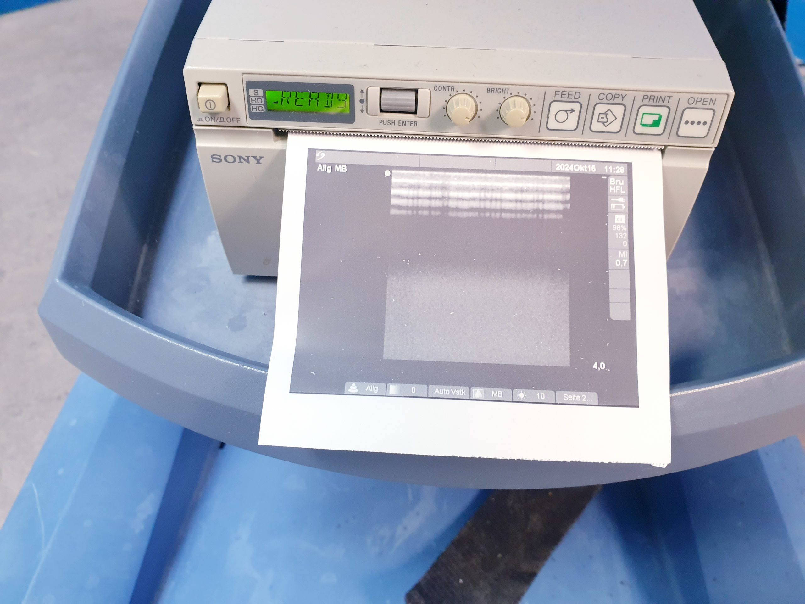 SonoSite MicroMaxx + Linear + Konvex – DOM 2009 thumbnail 8