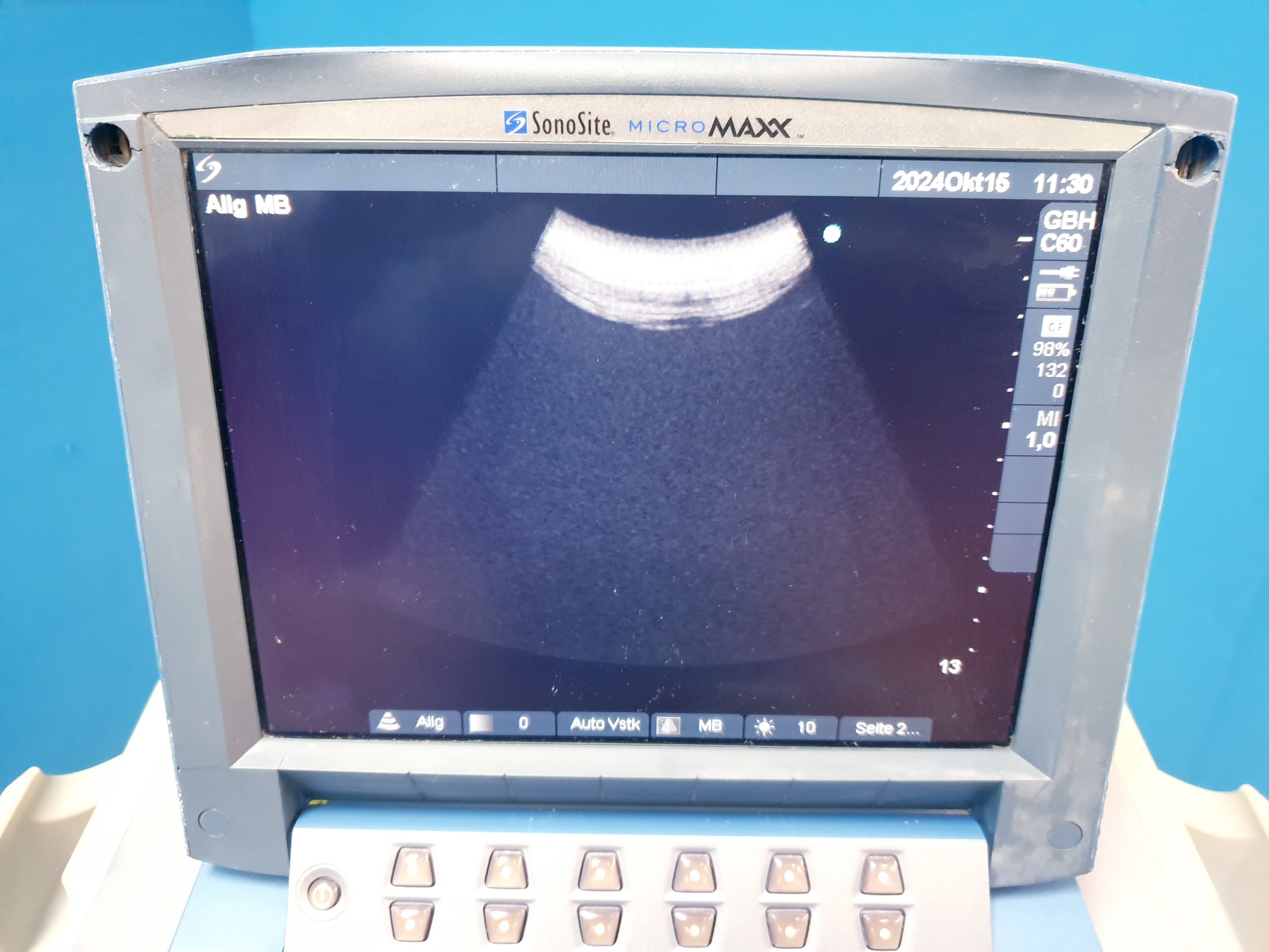 SonoSite MicroMaxx + Linear + Konvex – DOM 2009 thumbnail 12