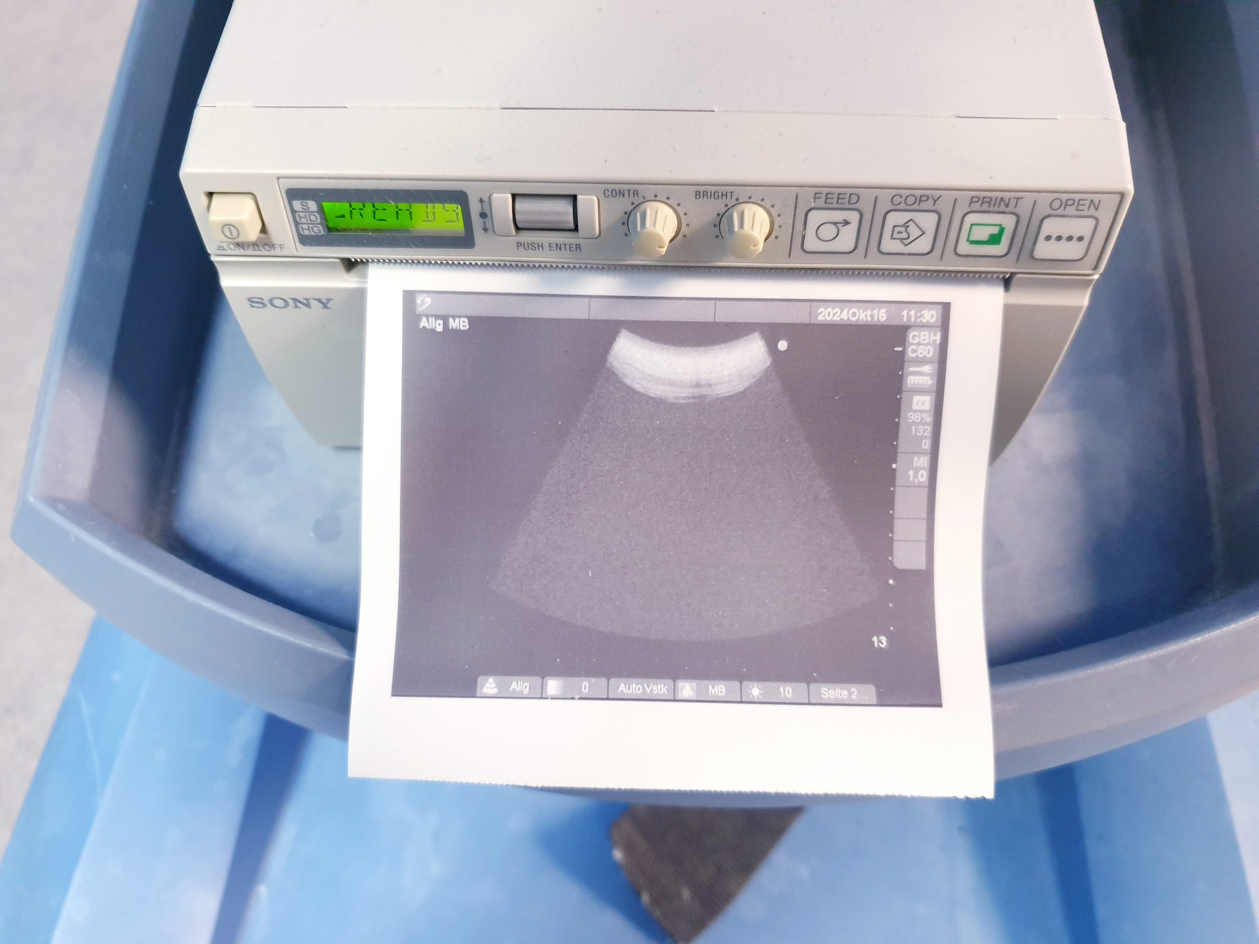 SonoSite MicroMaxx + Linear + Konvex – DOM 2009 thumbnail 13