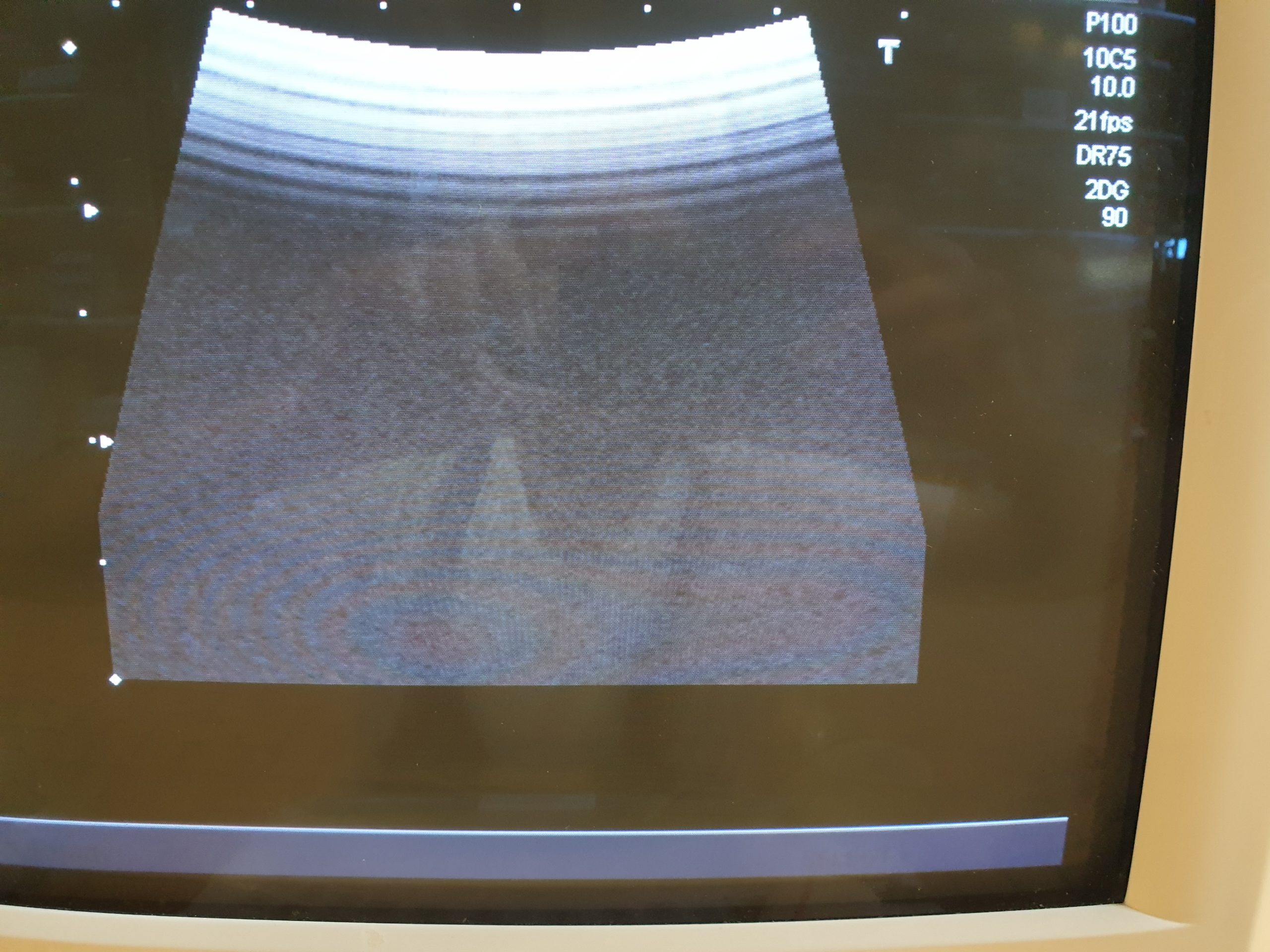 Toshiba PVF-738F Intraoperative Convex Probe — image 1 of 5