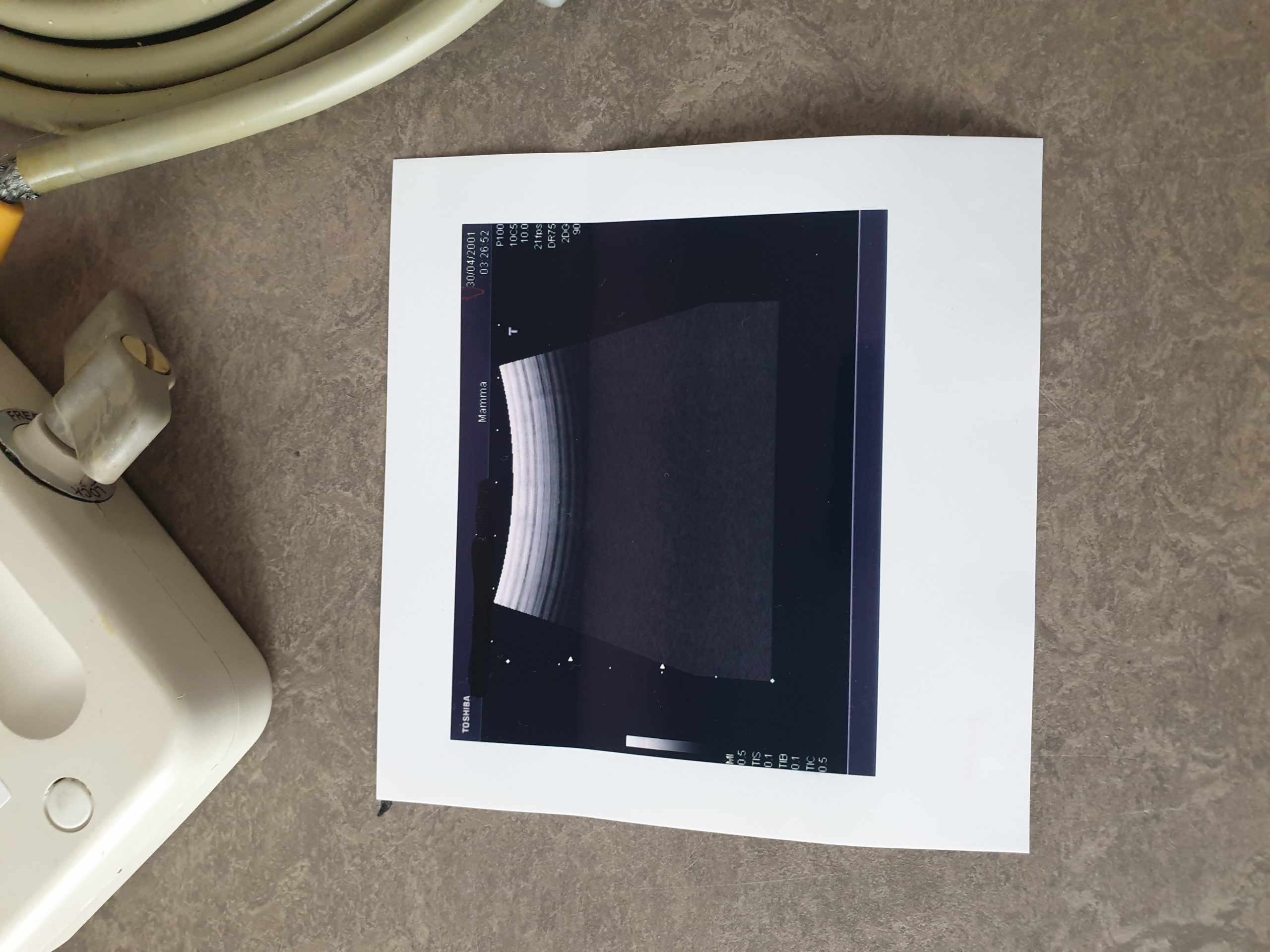 Toshiba PVF-738F Intraoperative Convex Probe thumbnail 3