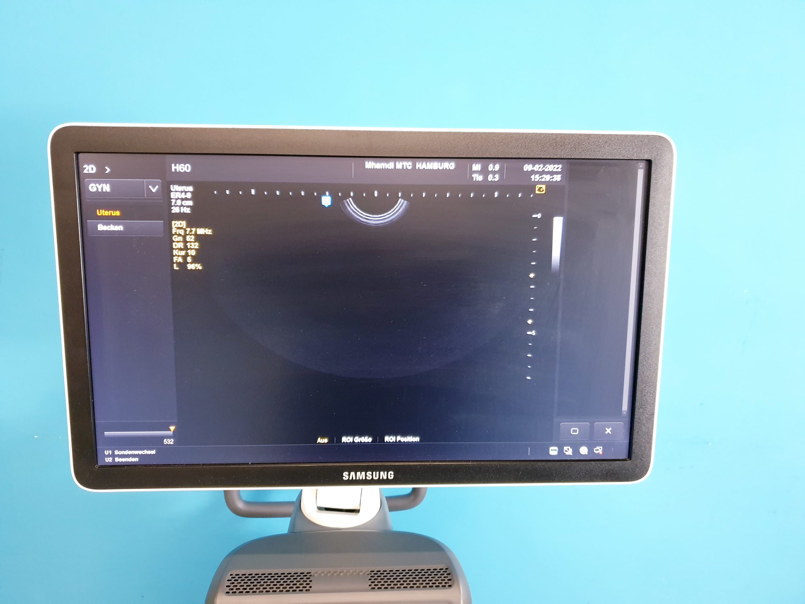 Samsung UGEO H60, 2.01, CV1-8AD, LA3-14AD, ER4-9 Gynecology DOM 2016 thumbnail 6