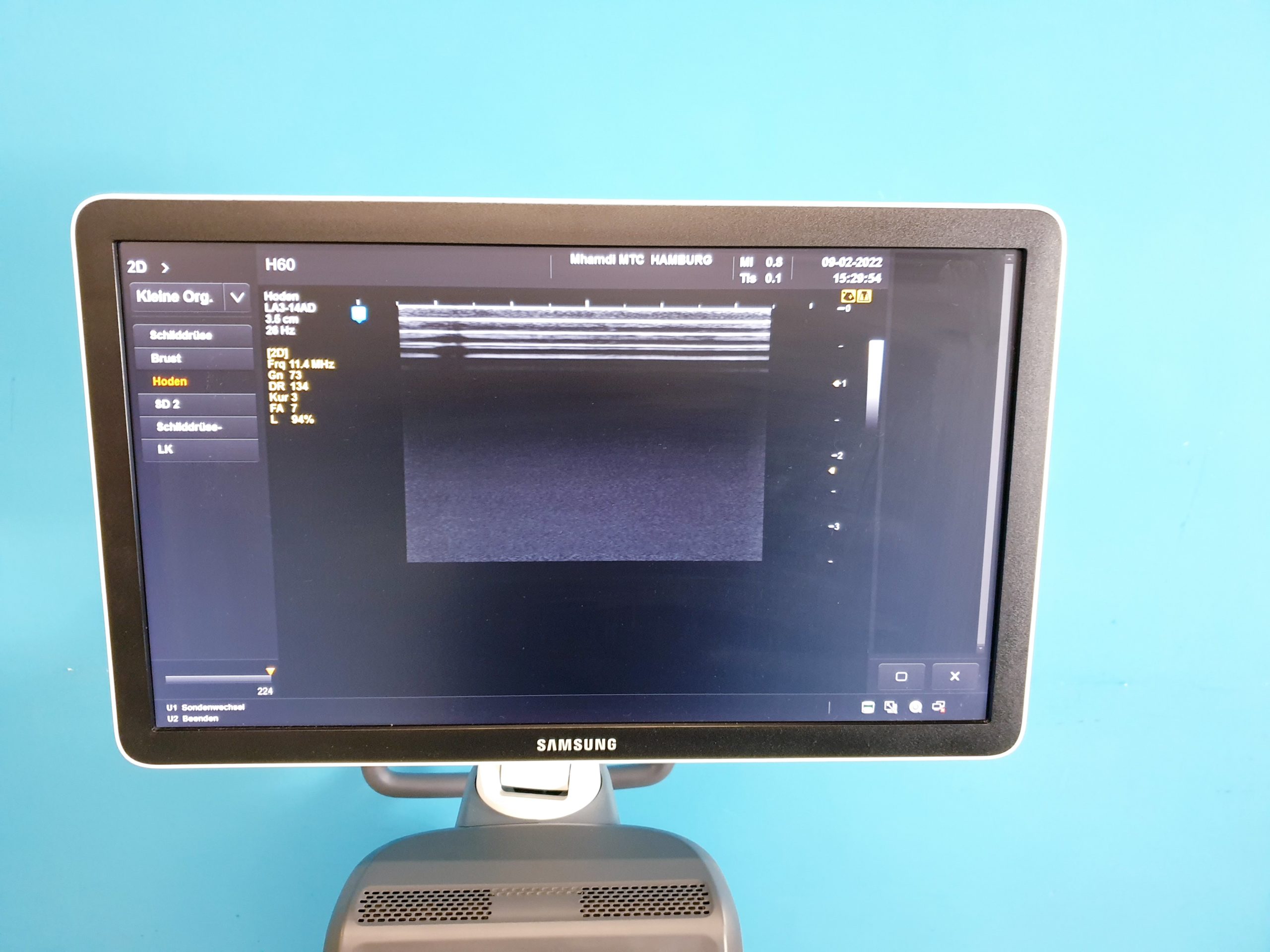 Samsung UGEO H60, 2.01, CV1-8AD, LA3-14AD, ER4-9 Gynecology DOM 2016 thumbnail 8