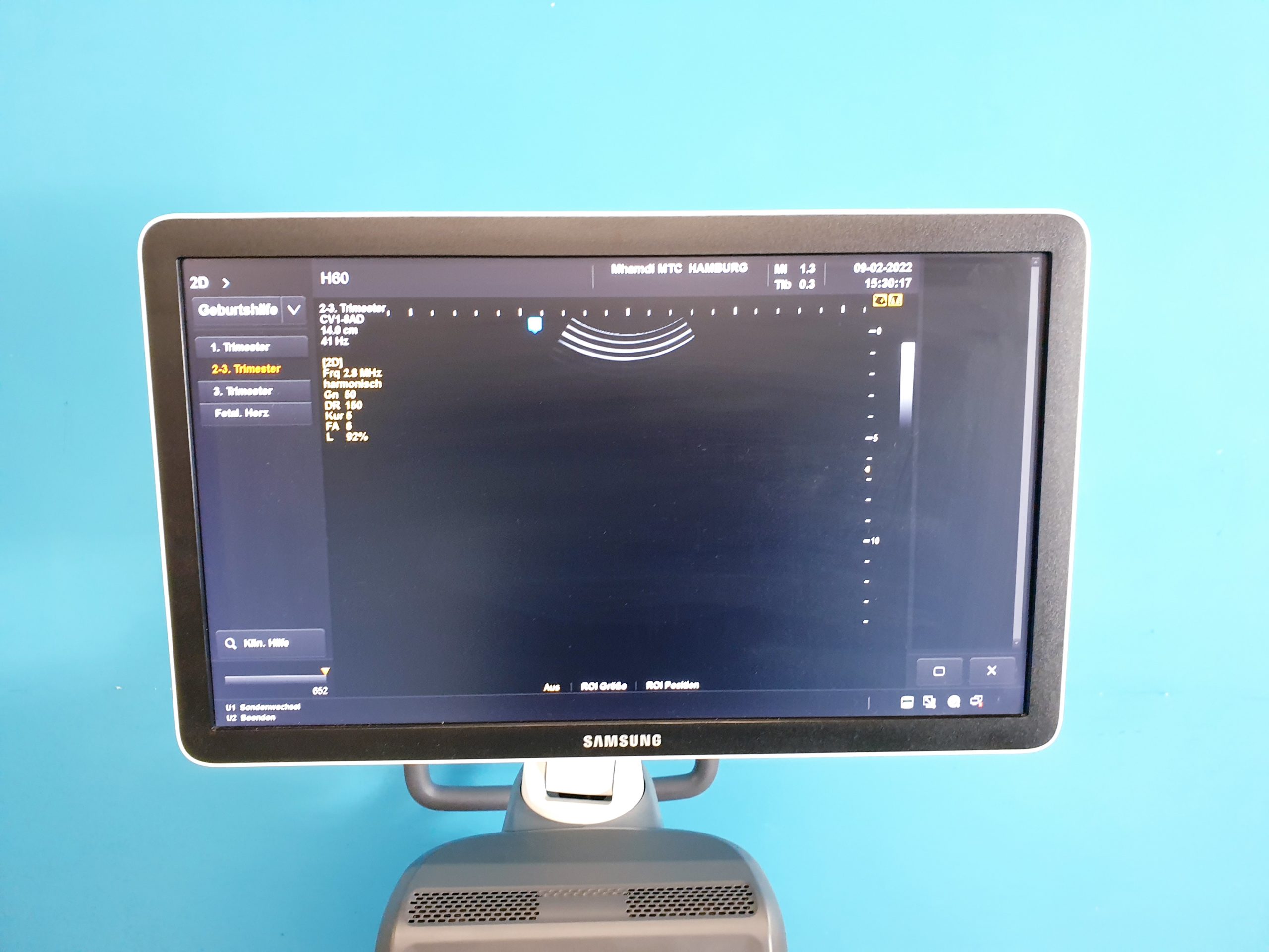 Samsung UGEO H60, 2.01, CV1-8AD, LA3-14AD, ER4-9 Gynecology DOM 2016 thumbnail 10