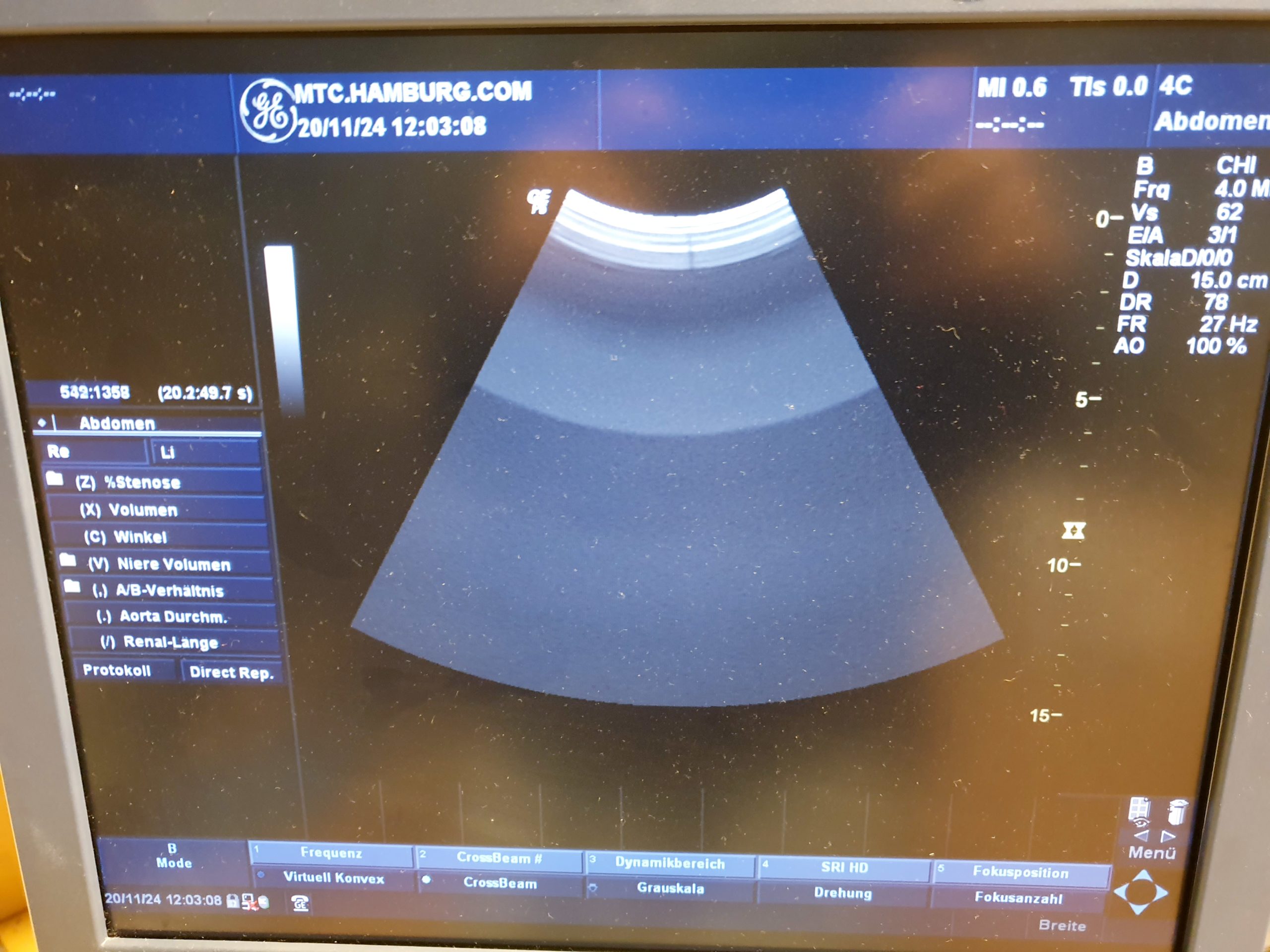 GE 4C Convex Probe thumbnail 8