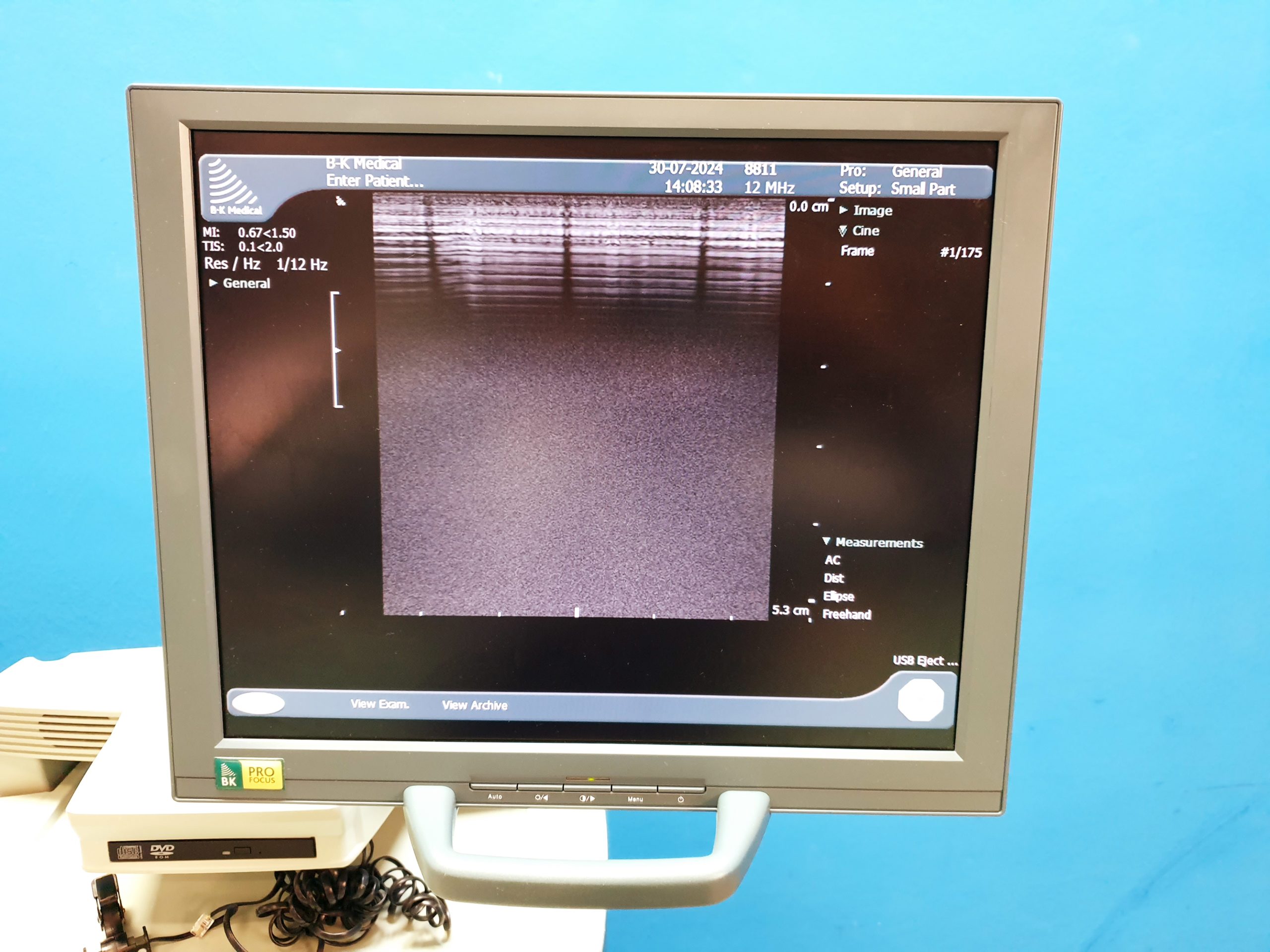 BK Medical Typ 8811 12-5 MHz linear Ultraschallsonde thumbnail 3