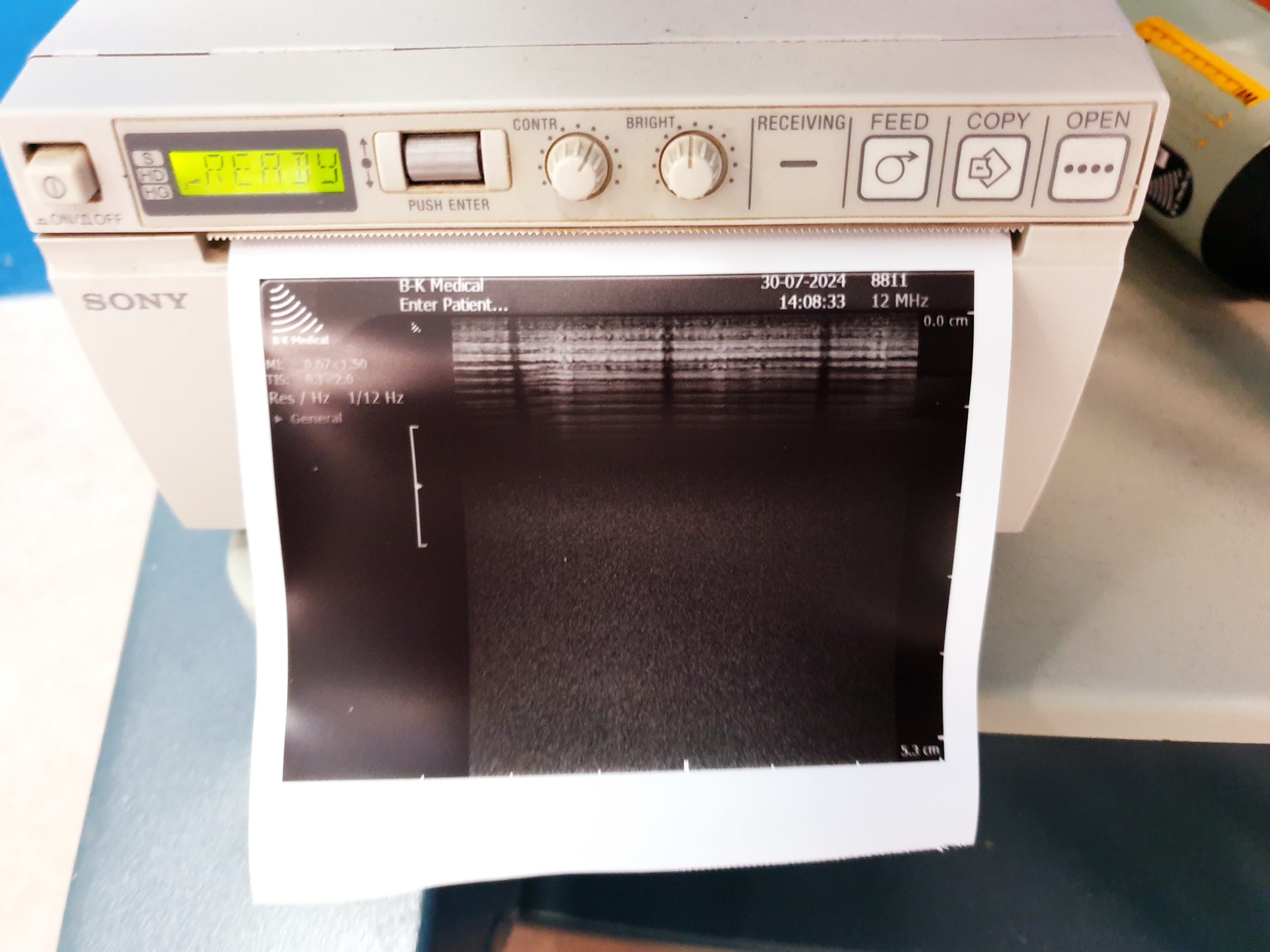 BK Medical Typ 8811 12-5 MHz linear Ultraschallsonde thumbnail 4