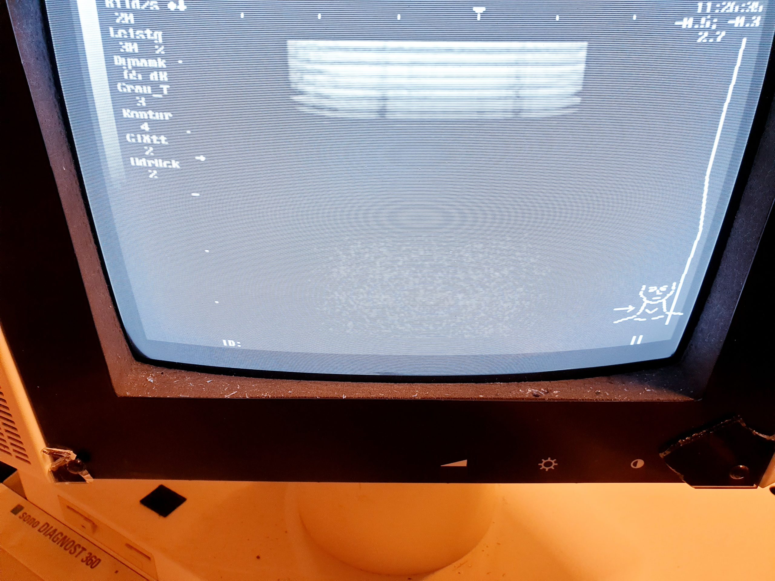 Philips / ATL 10.0 MHz Sonde Linear LA10040 thumbnail 4