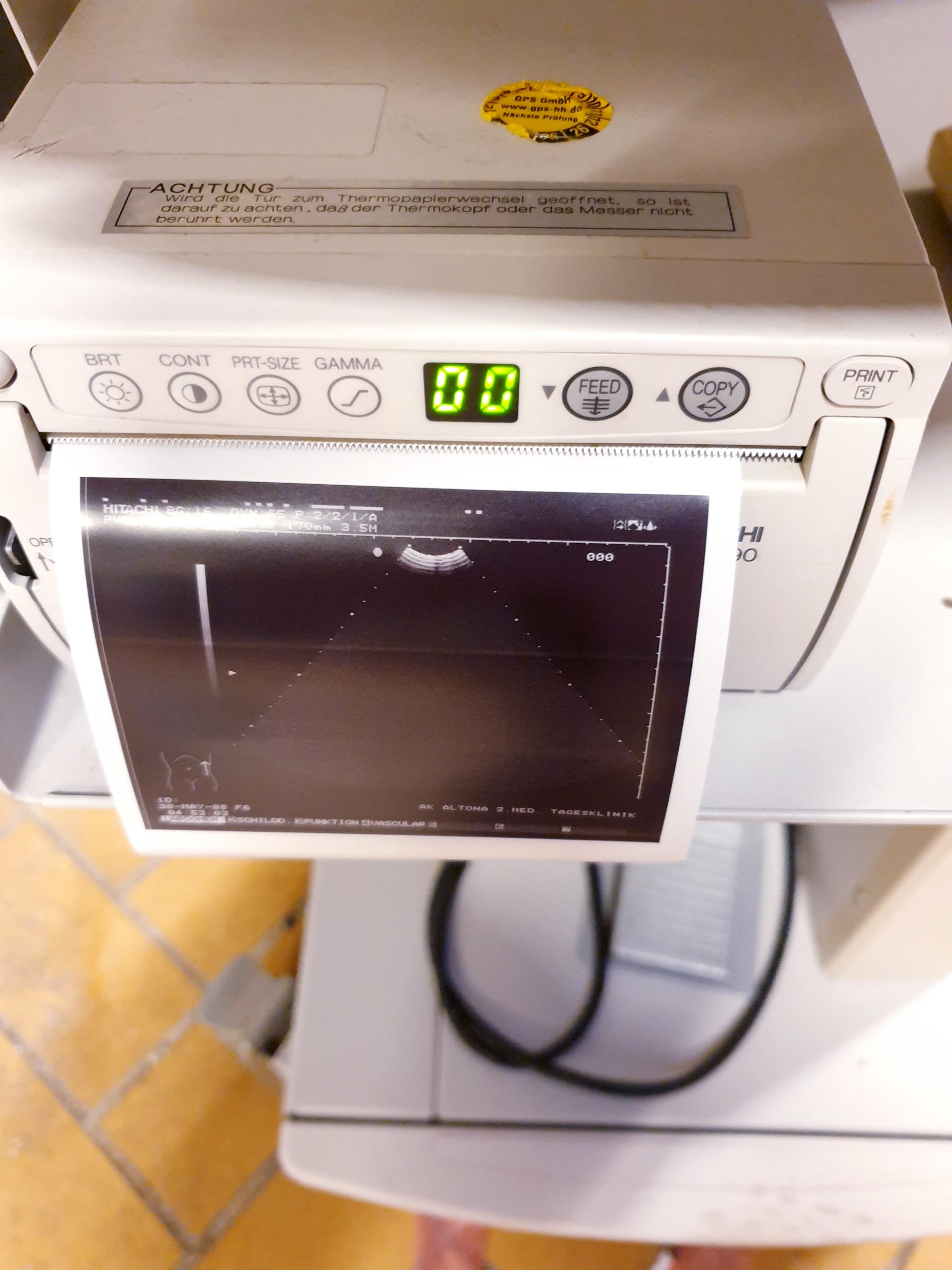 Hitachi EUP-C312T Ultraschallsonde Mikro Konvex Sonde thumbnail 4