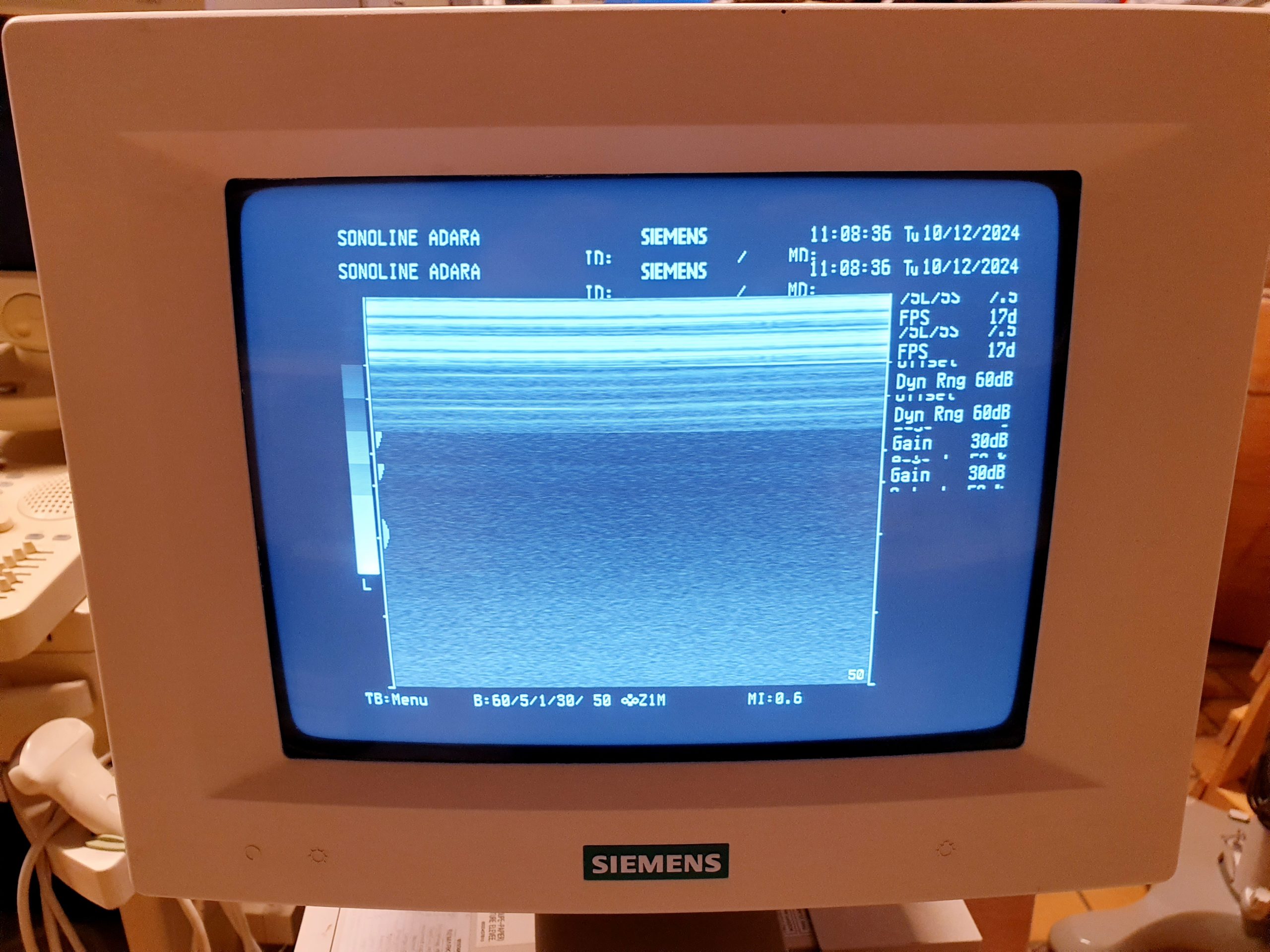 Siemens 7.5L75S Linear Sonde 7.5MHz thumbnail 3