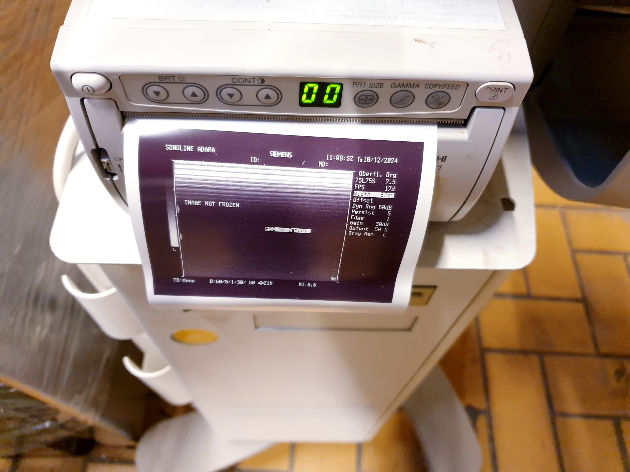 Siemens 7.5L75S Linear Sonde 7.5MHz thumbnail 4