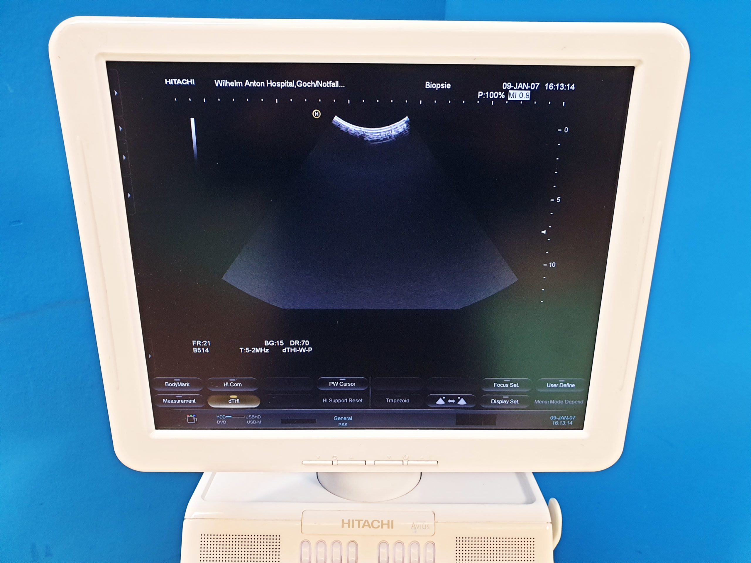 Hitachi EUP-B514 Intraoperative-Sonde Through-Crystal Biopsy Probe thumbnail 3