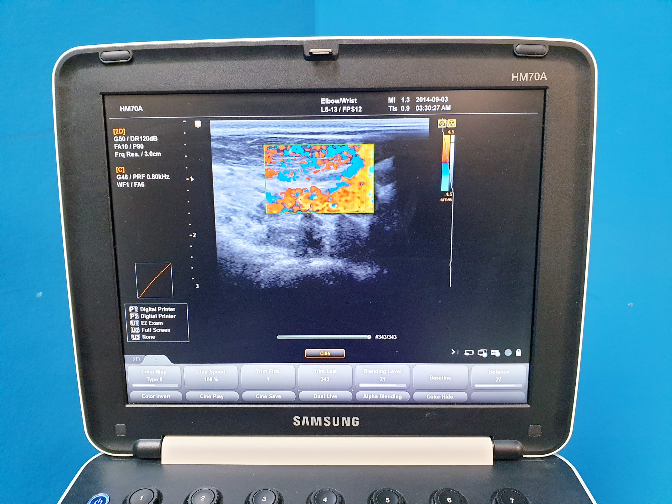 Samsung HM-70A Doppler +L5-13 Linear Sonde thumbnail 4