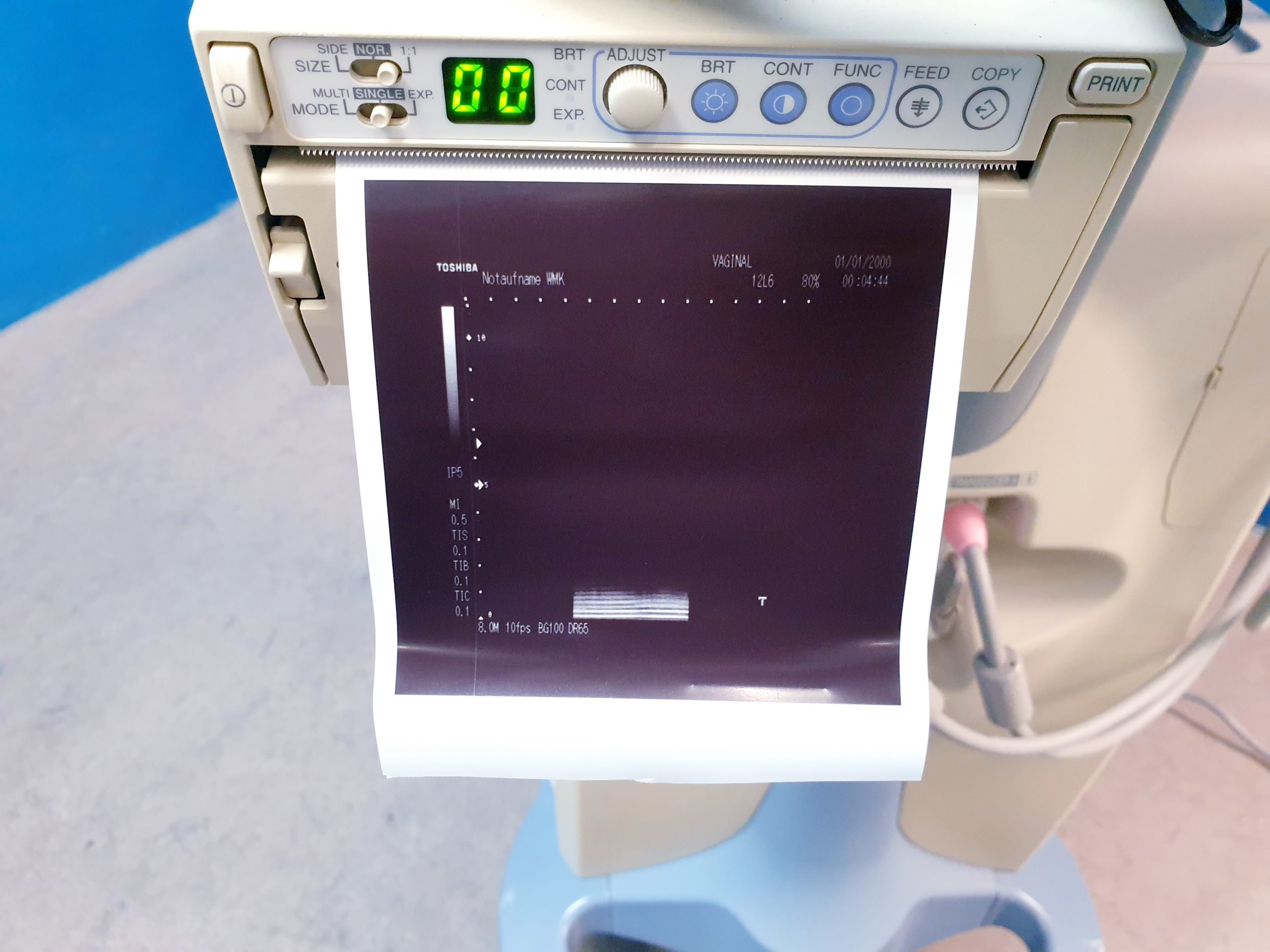 Toshiba PLQ-805A Linear Sonde thumbnail 5