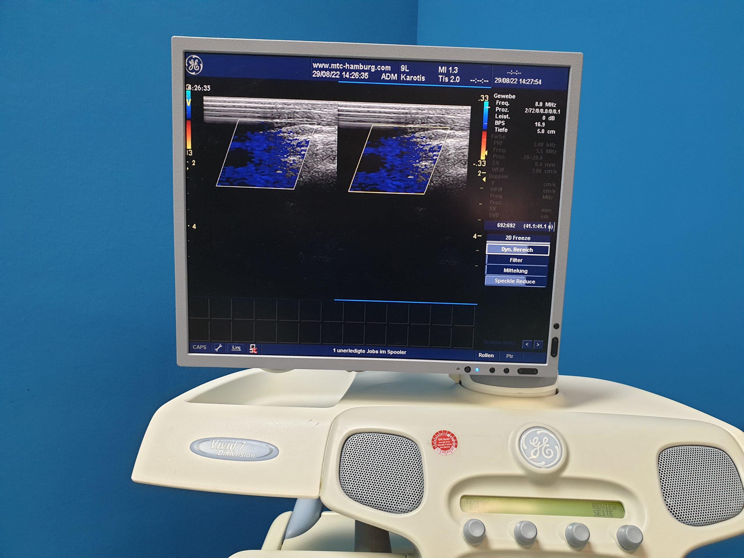 GE Vivid 7 Dimension mit GE M4S Echo Kardio Sonde und 9L Linear SW: 2.0.8 Application SW: 6.1.5 thumbnail 5
