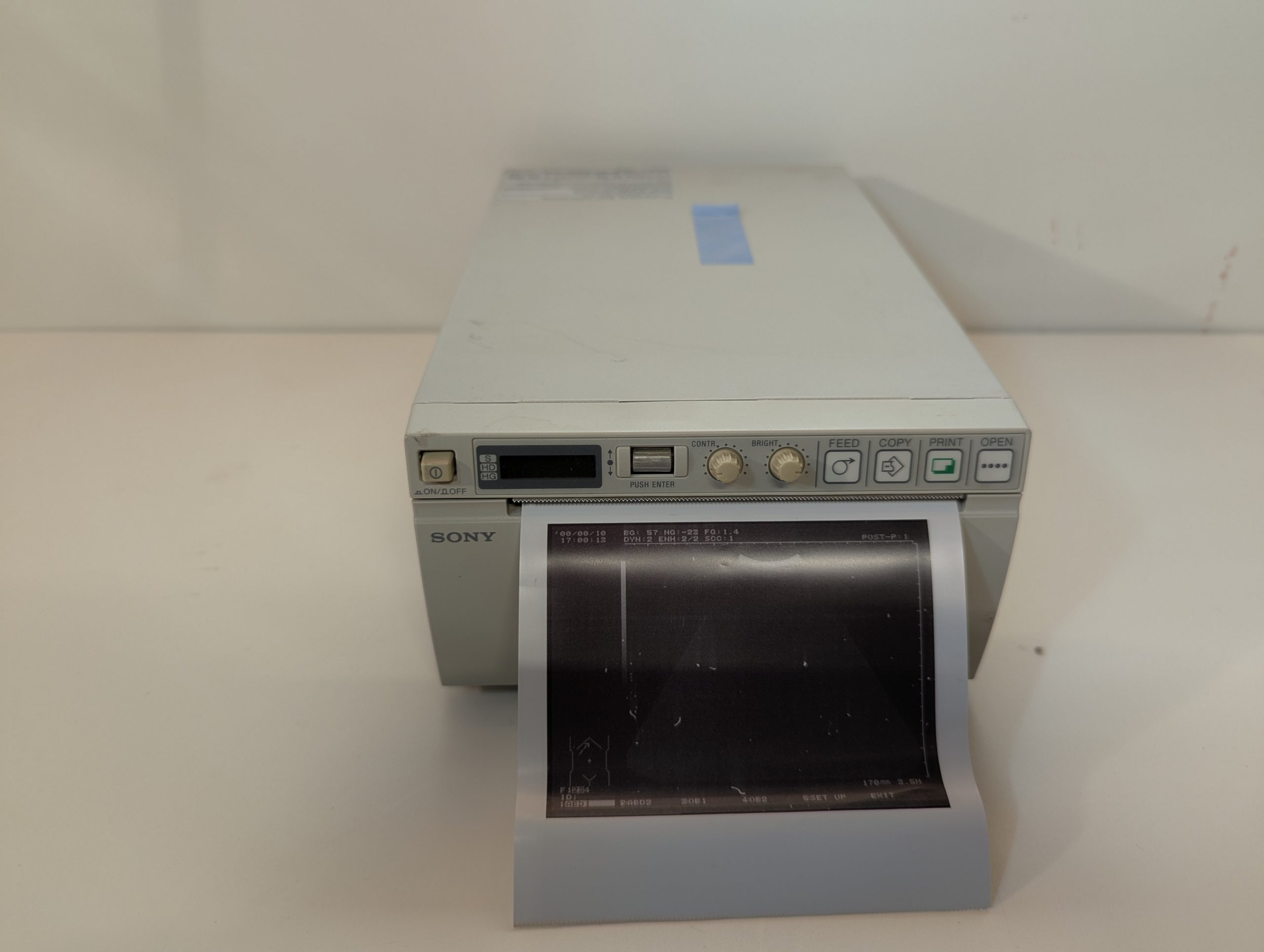 Sony UP-897MD Ultraschalldrucker Thermodrucker — image 1 of 9