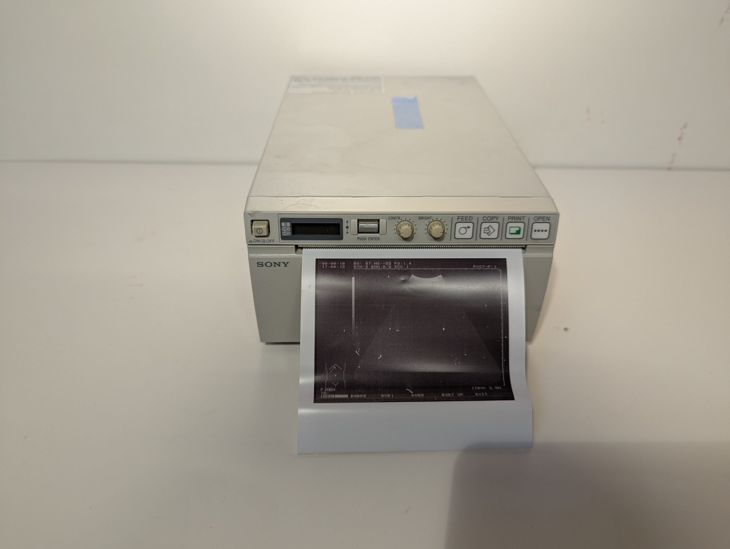 Sony UP-897MD Ultraschalldrucker Thermodrucker thumbnail 2