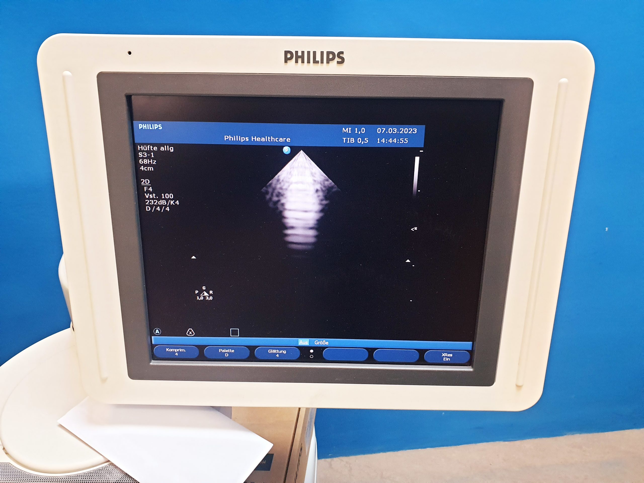 Philips – S3-1 Kardiosonde – Echosonde thumbnail 2