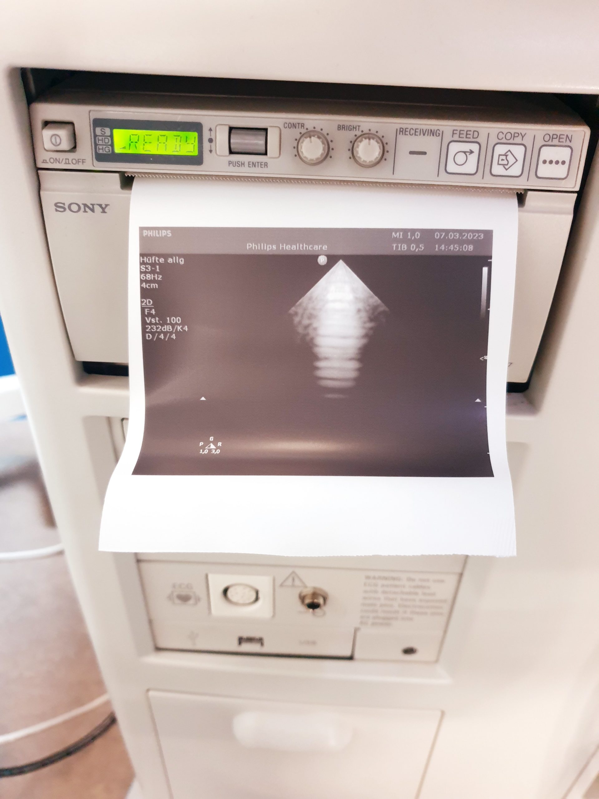 Philips – S3-1 Kardiosonde – Echosonde thumbnail 3