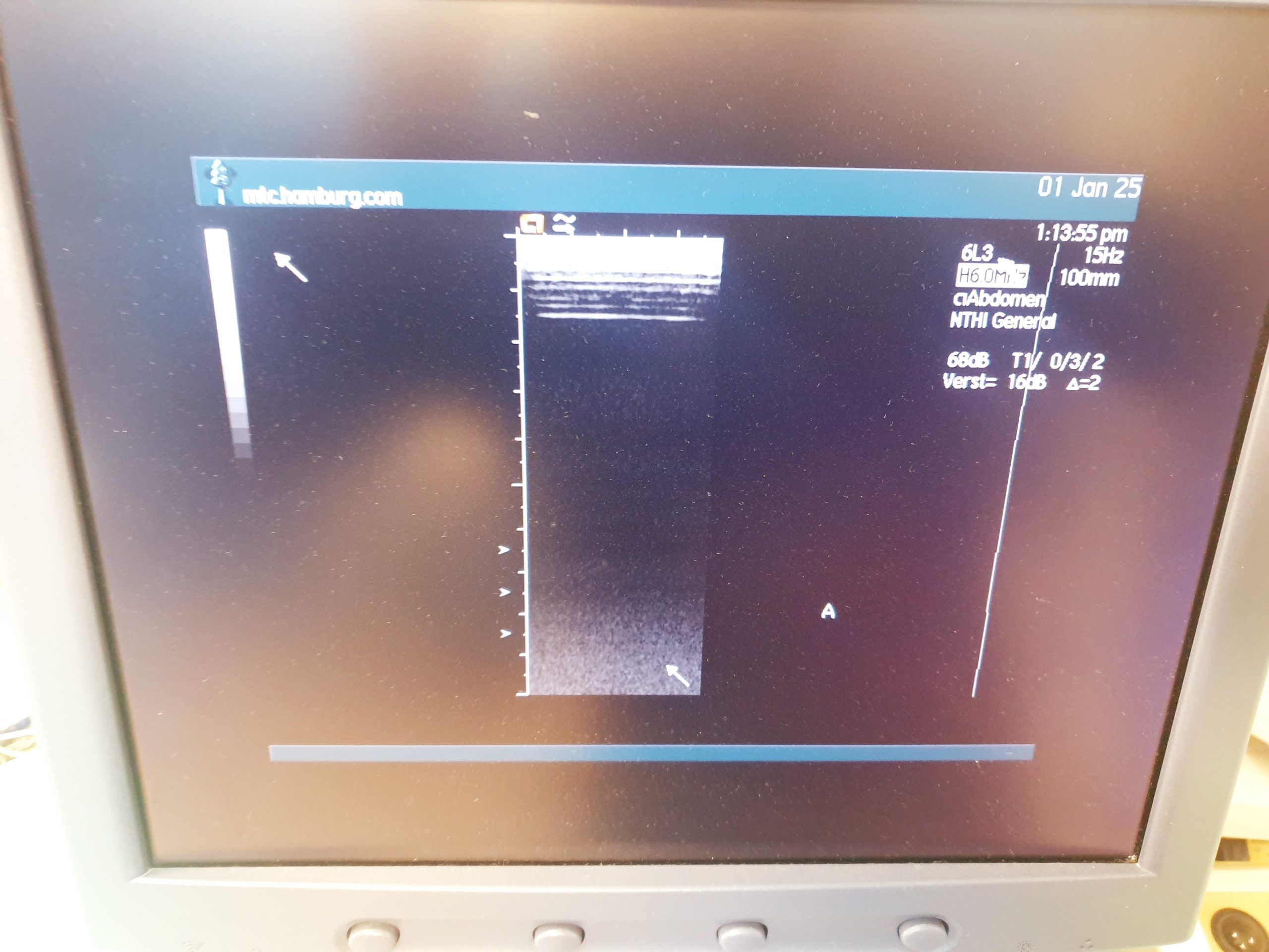 Siemens Acuson 6L3 Lineare Sonde thumbnail 5