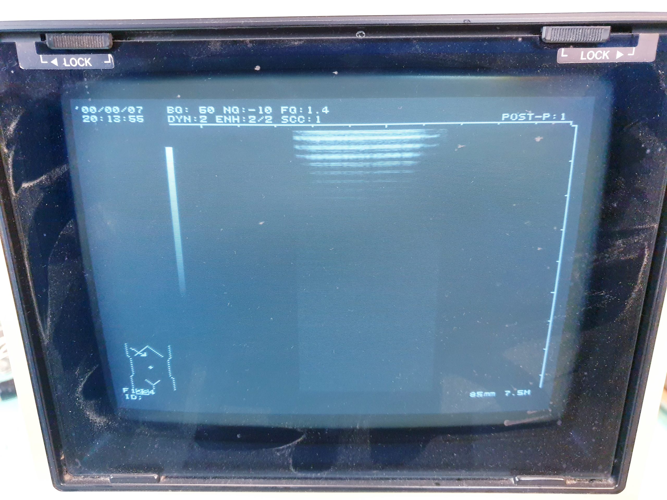 Hitachi EUP-L33ST Linear 7.5 – 5 MHz Schilddrüse Mamma Small Part thumbnail 3
