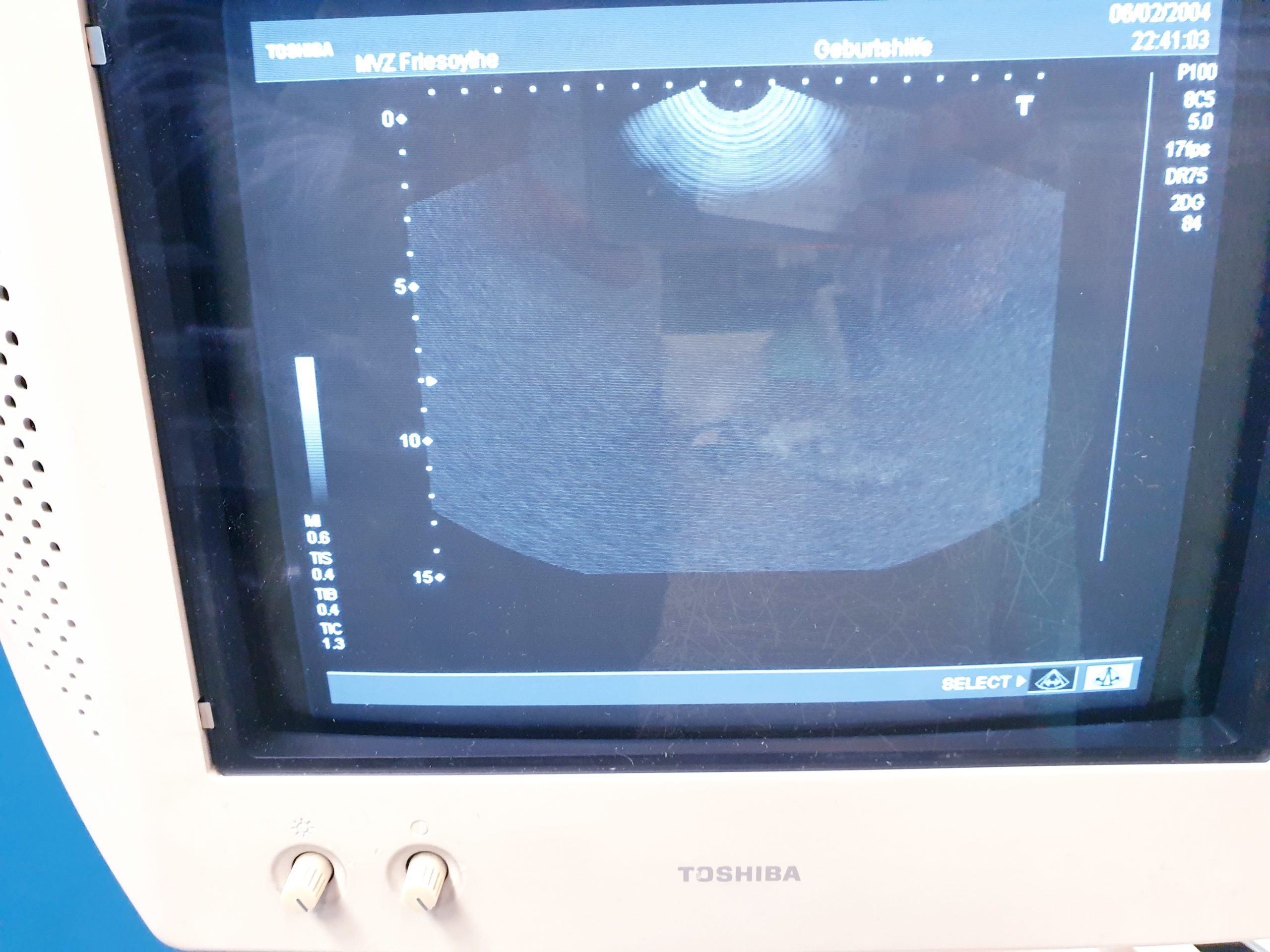 Toshiba PVM-651VT Vaginal Sonde thumbnail 4