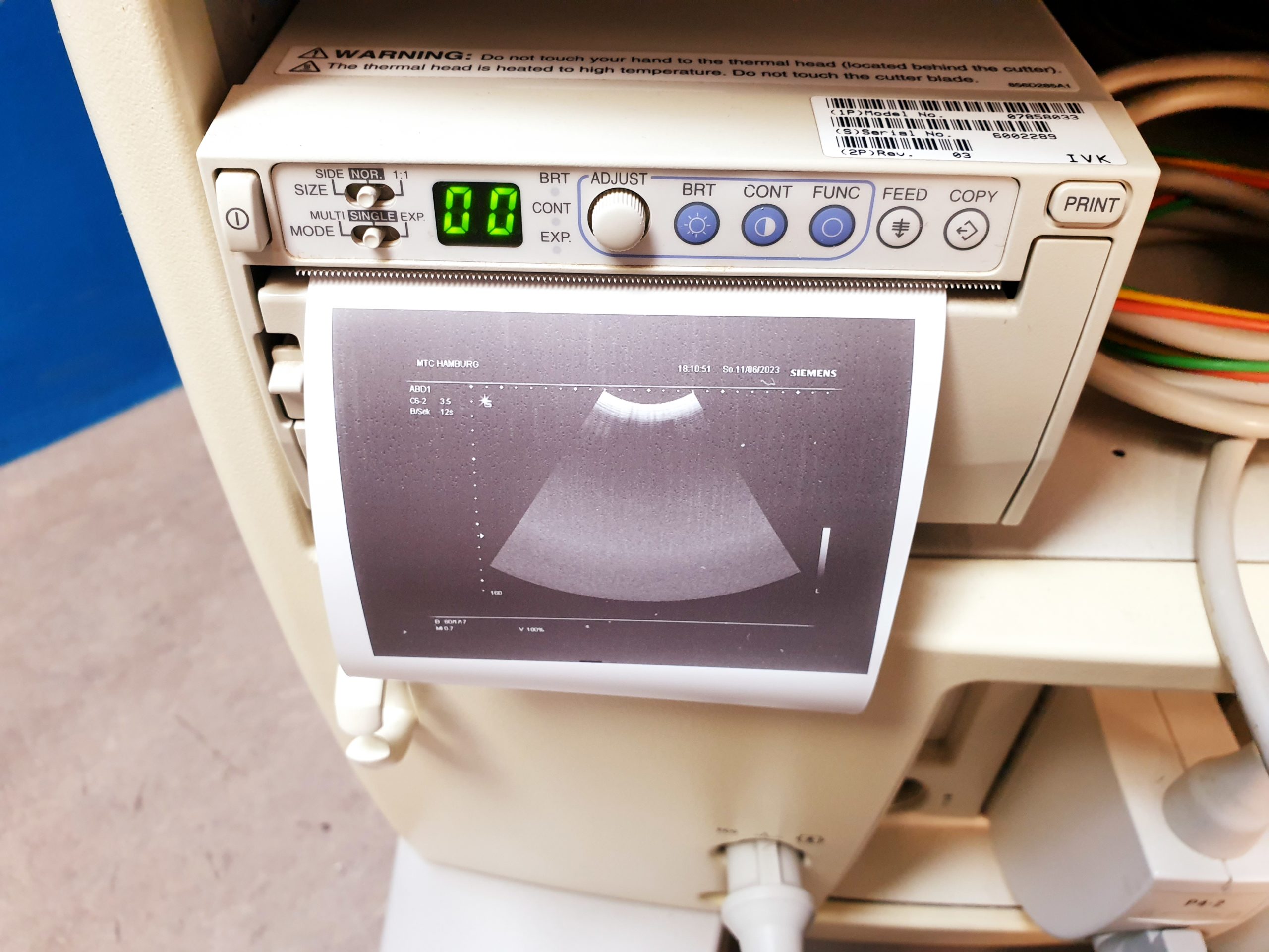 Siemens G60S + C6-2 -+ P4-2 + L10-5 Doppler – Farbdoppler thumbnail 4