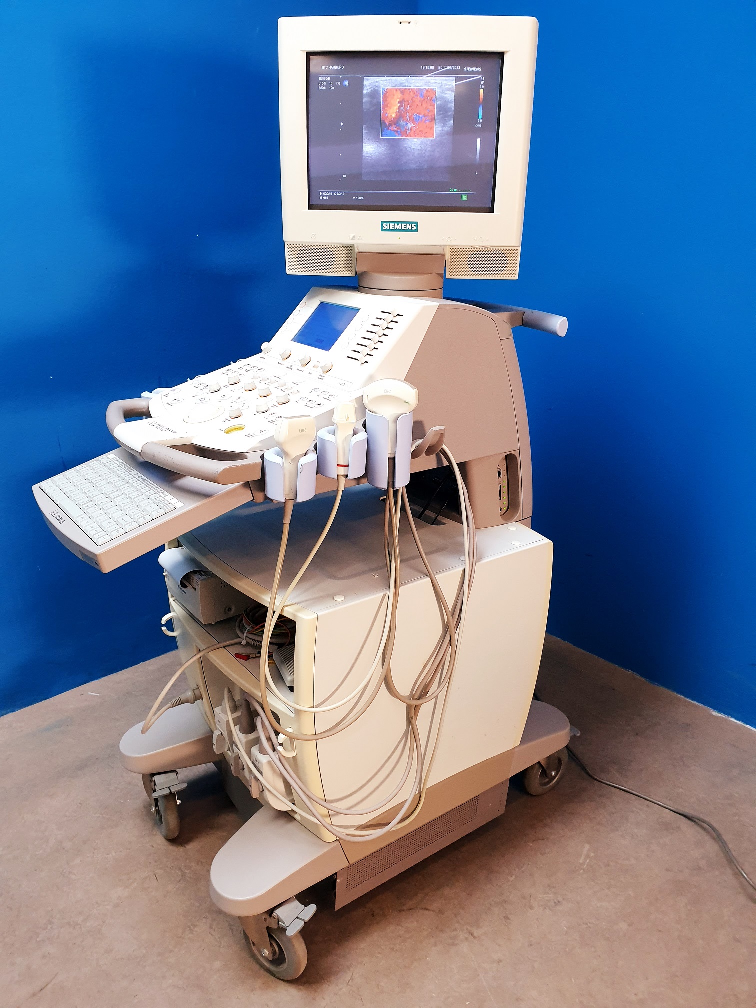 Siemens G60S + C6-2 -+ P4-2 + L10-5 Doppler – Farbdoppler thumbnail 9