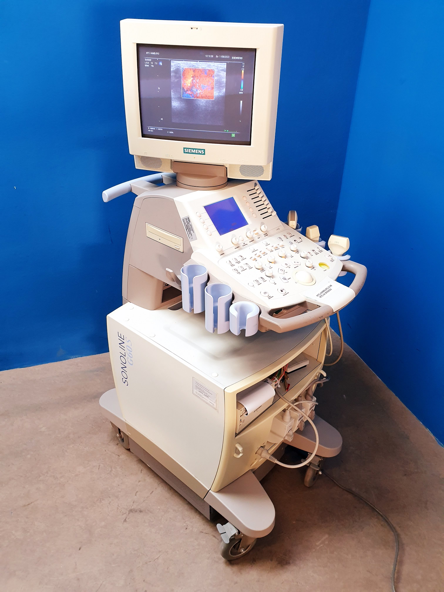 Siemens G60S + C6-2 -+ P4-2 + L10-5 Doppler – Farbdoppler thumbnail 10