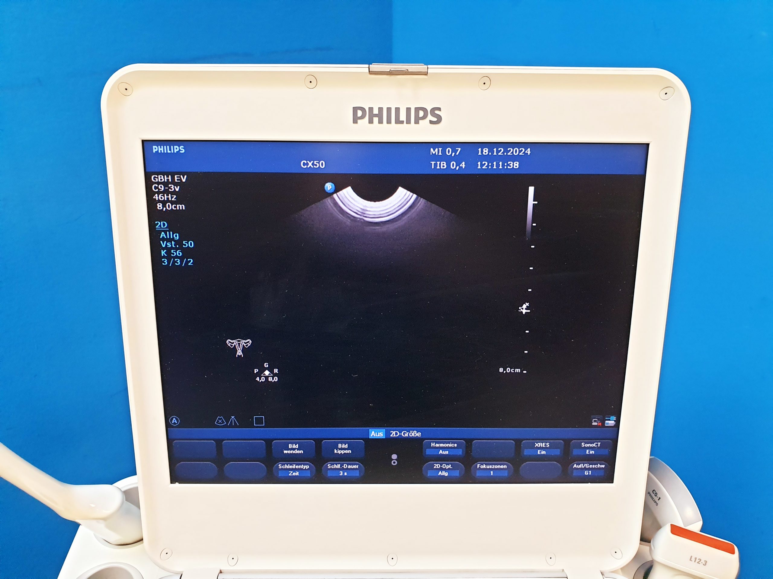 Philips CX50 – CX 50Tragbare Ultraschallgerät CS-3V + C5-1 + L12-3 thumbnail 6