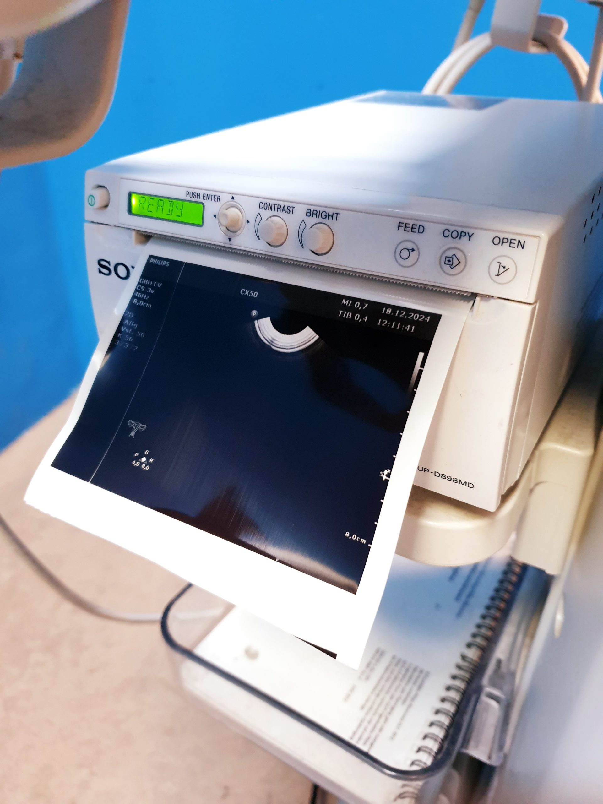 Philips CX50 – CX 50Tragbare Ultraschallgerät CS-3V + C5-1 + L12-3 thumbnail 7