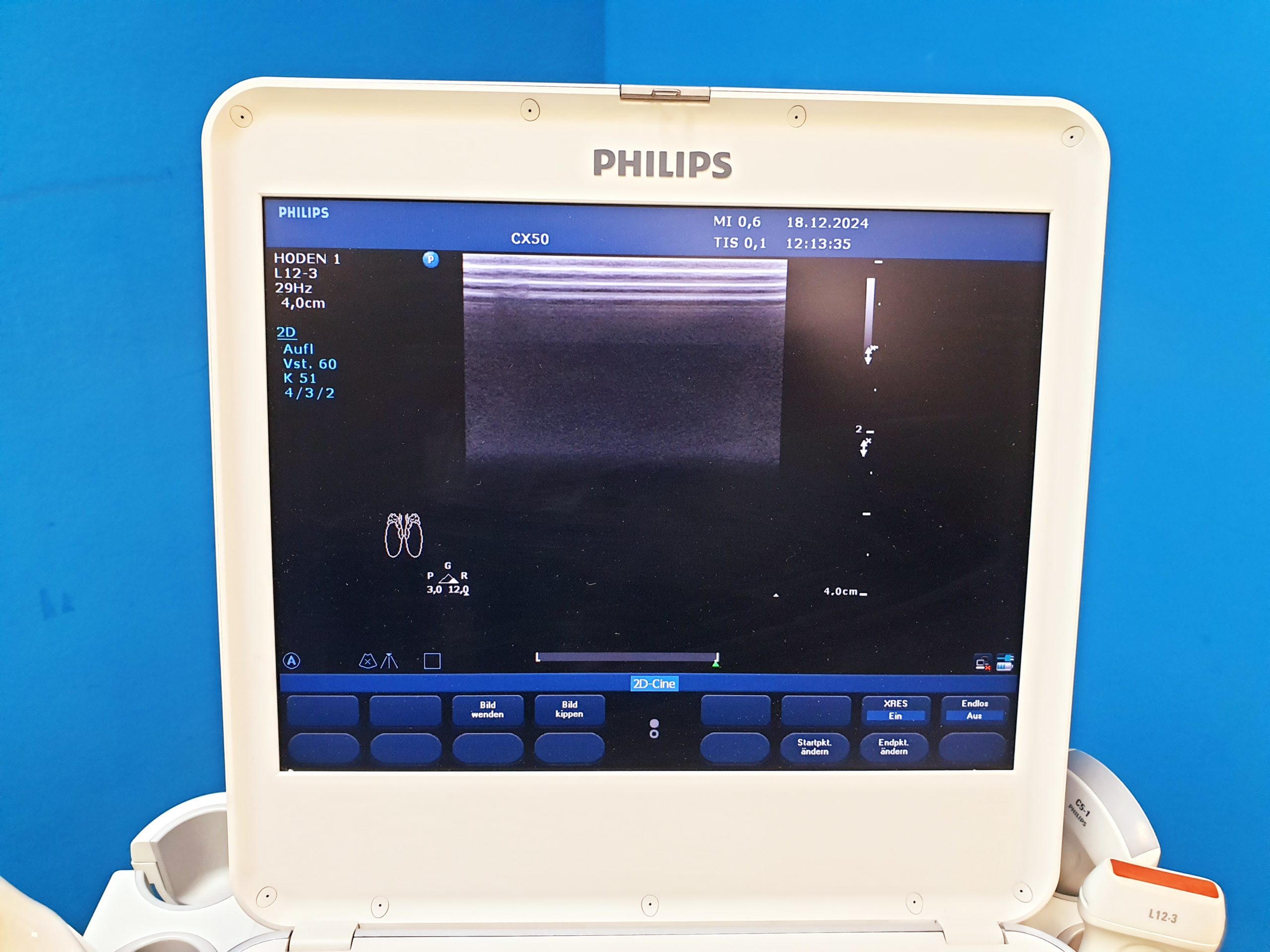 Philips CX50 – CX 50Tragbare Ultraschallgerät CS-3V + C5-1 + L12-3 thumbnail 10