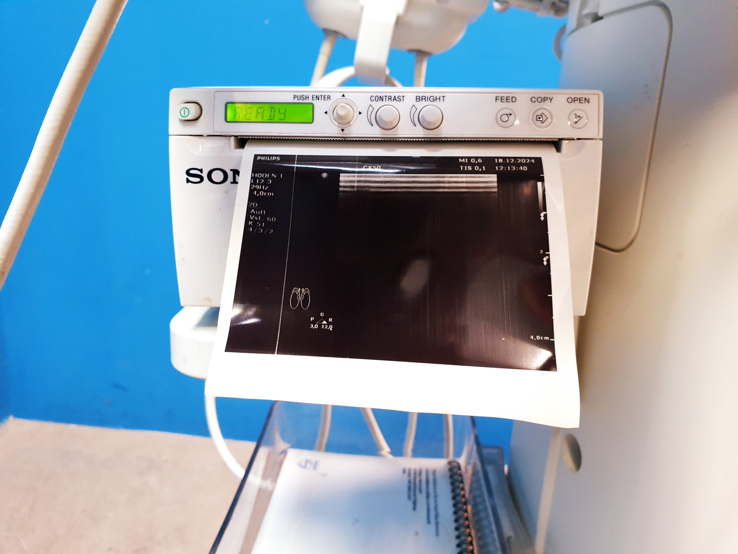 Philips CX50 – CX 50Tragbare Ultraschallgerät CS-3V + C5-1 + L12-3 thumbnail 11