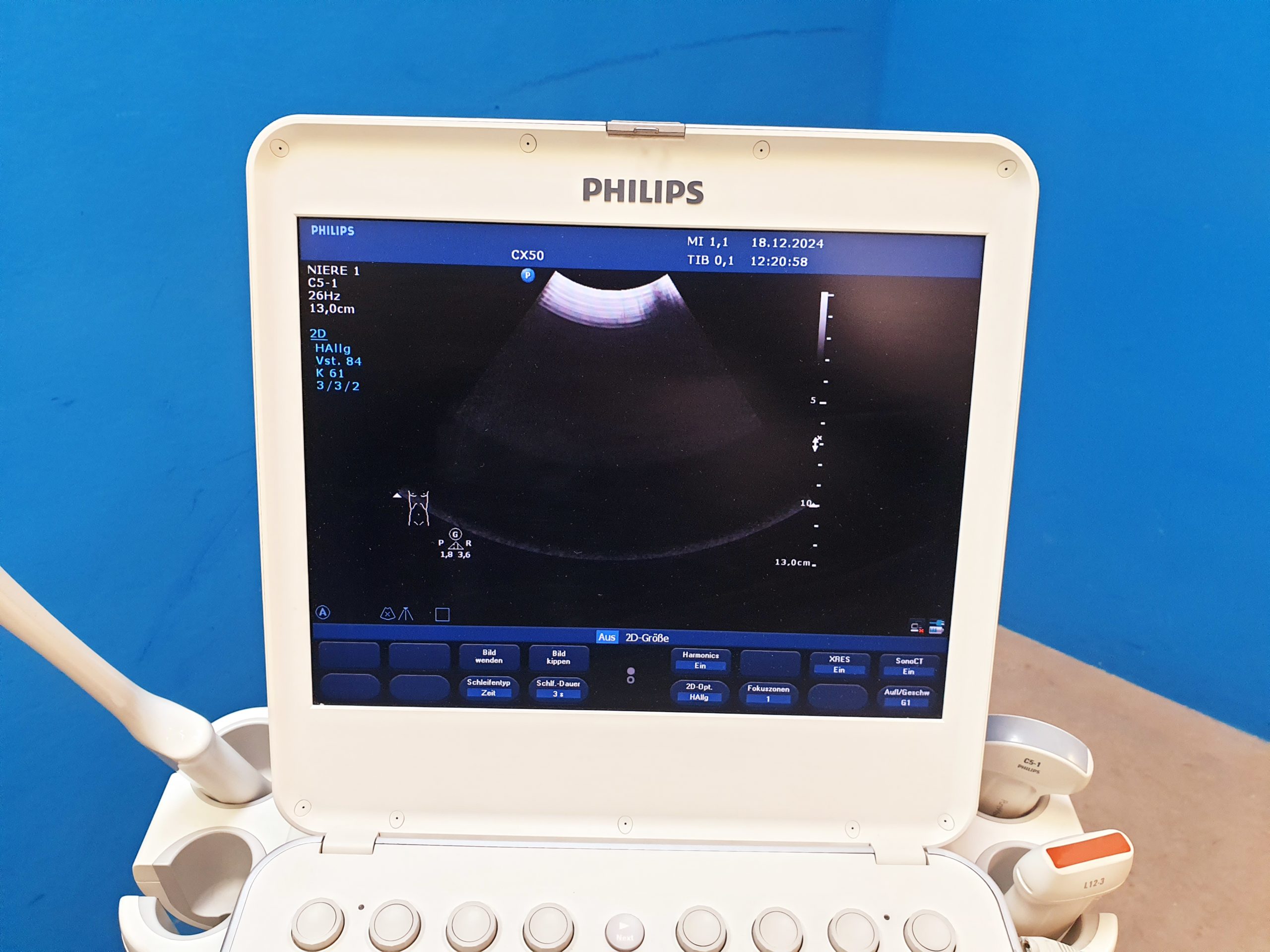 Philips CX50 – CX 50Tragbare Ultraschallgerät CS-3V + C5-1 + L12-3 thumbnail 16