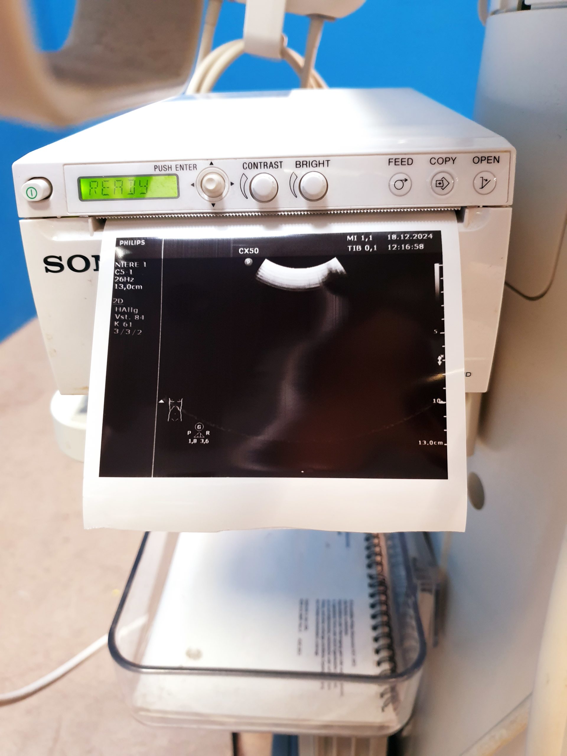 Philips CX50 – CX 50Tragbare Ultraschallgerät CS-3V + C5-1 + L12-3 thumbnail 17