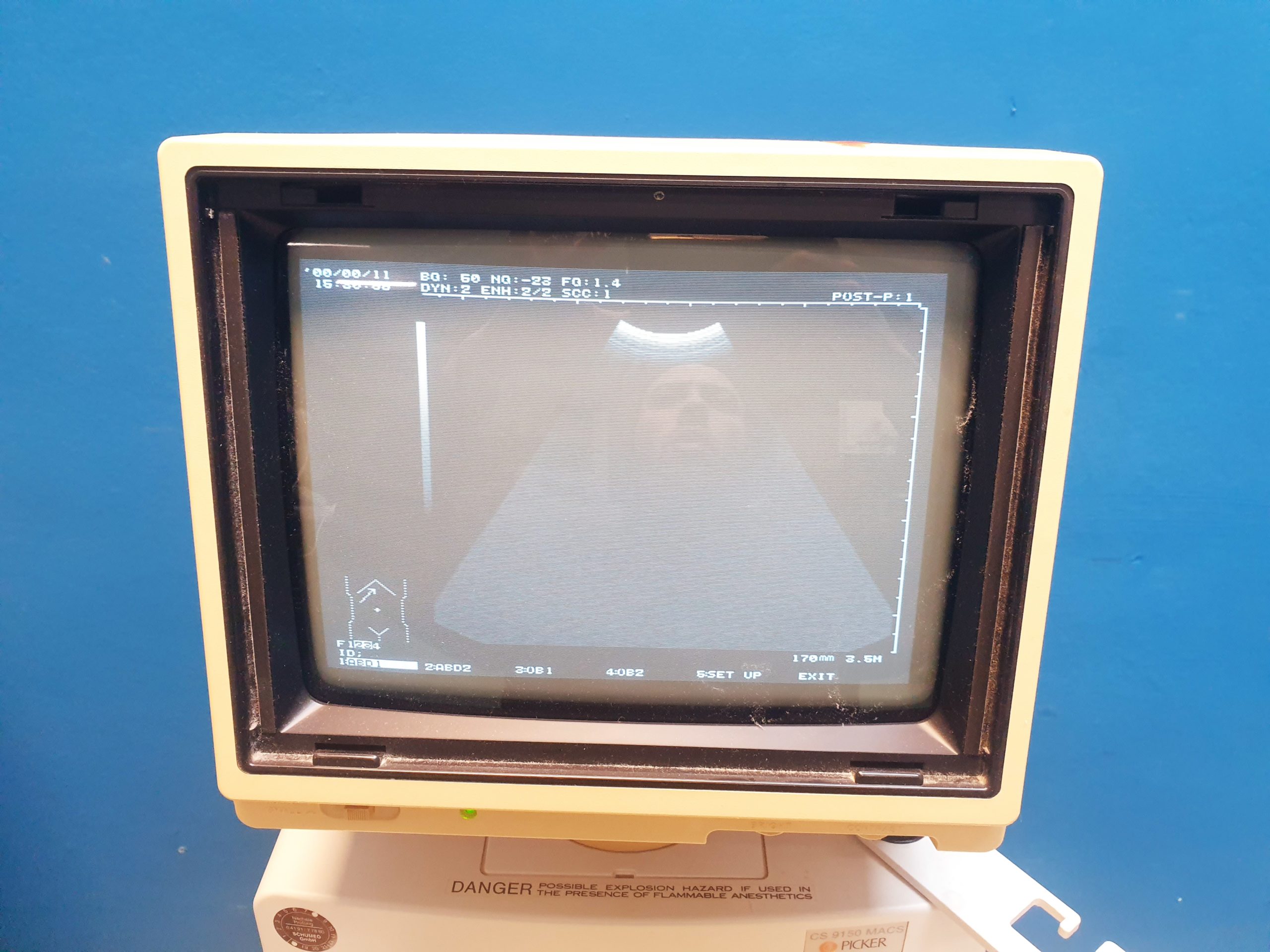 Hitachi – EUP-C314T Konvex Sonde – Probe thumbnail 3