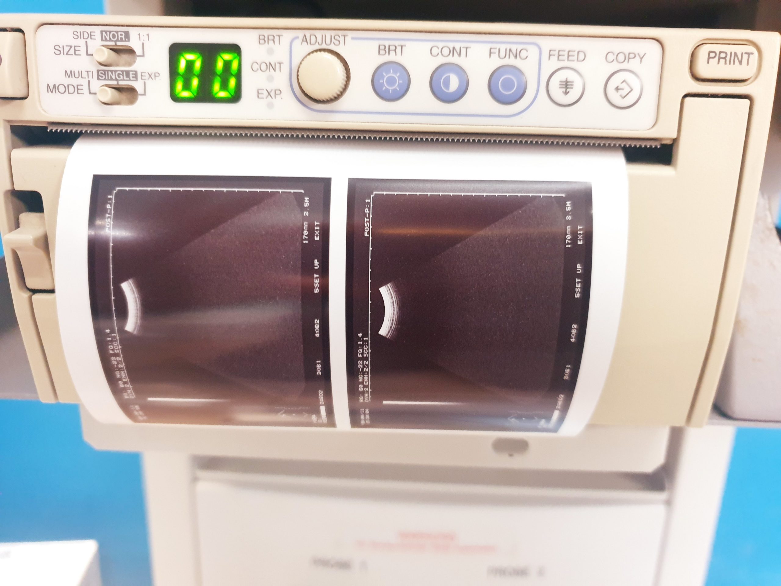 Hitachi – EUP-C314T Konvex Sonde – Probe thumbnail 4