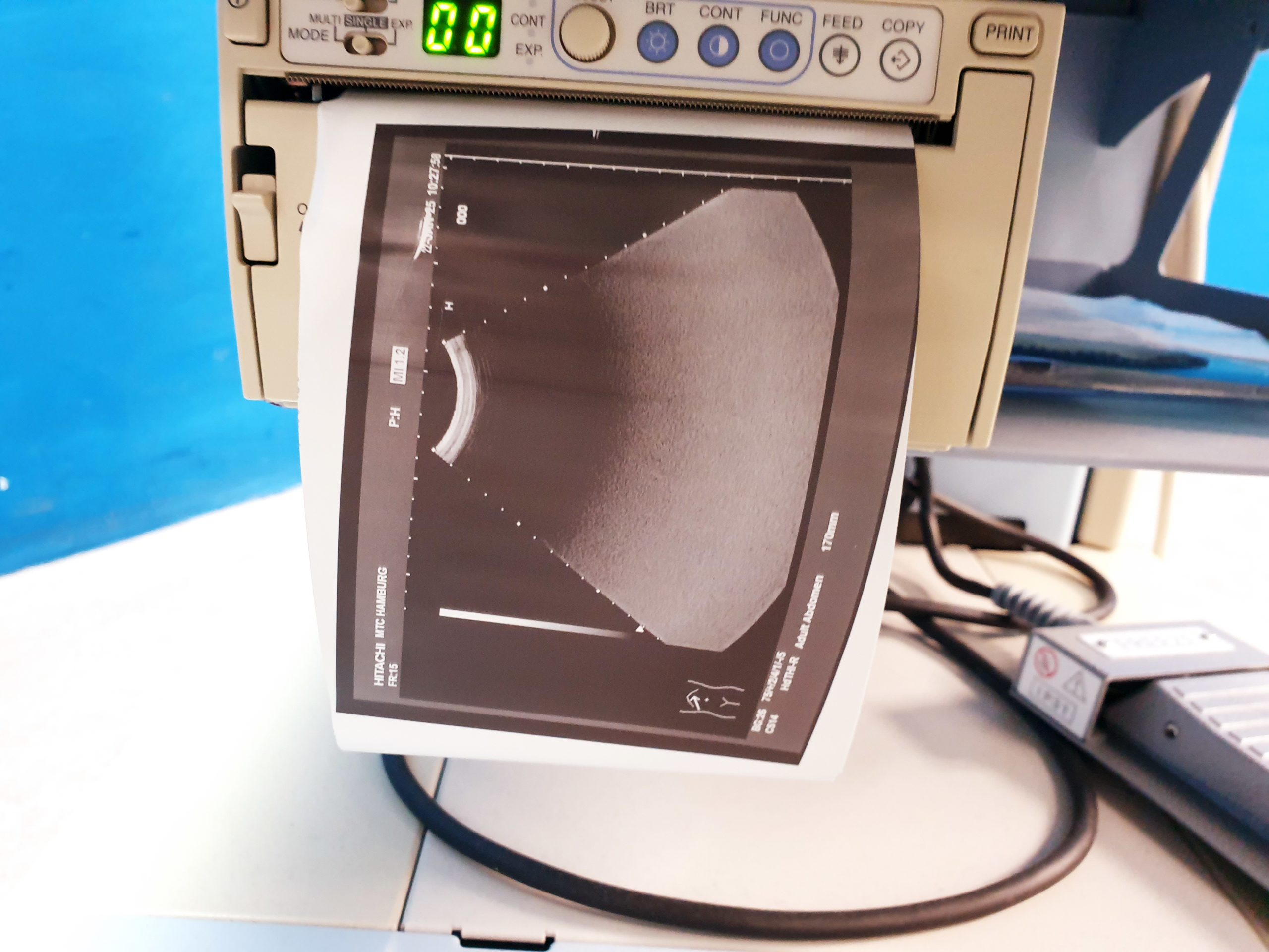 Hitachi EUP-C514 Convex 5.0 – 2.0 MHz Konvex Sonde thumbnail 2