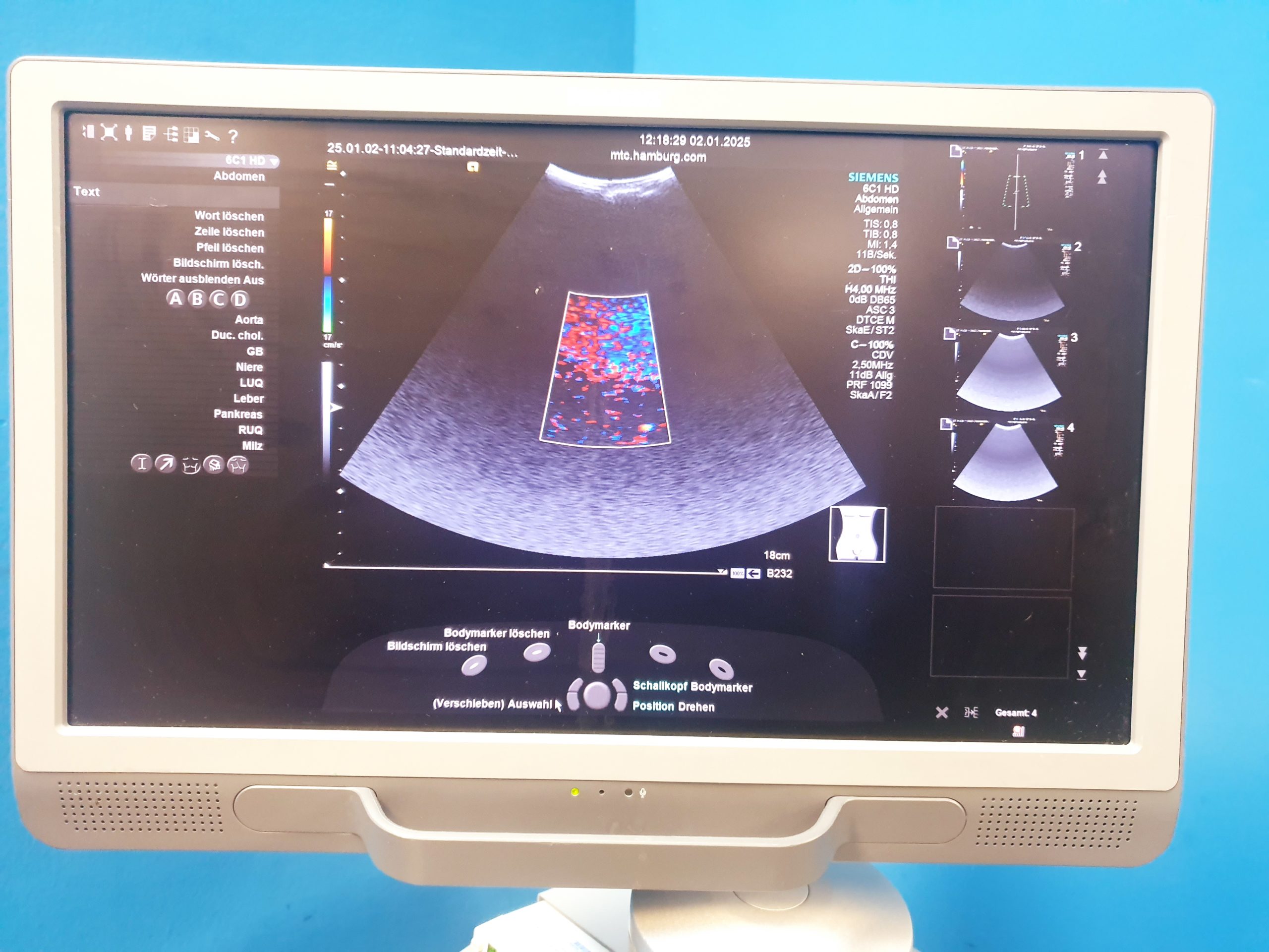 Siemens Acuson S2000 Doppler + 6C1HD + 4V1c Vector Array + 9L4 thumbnail 4