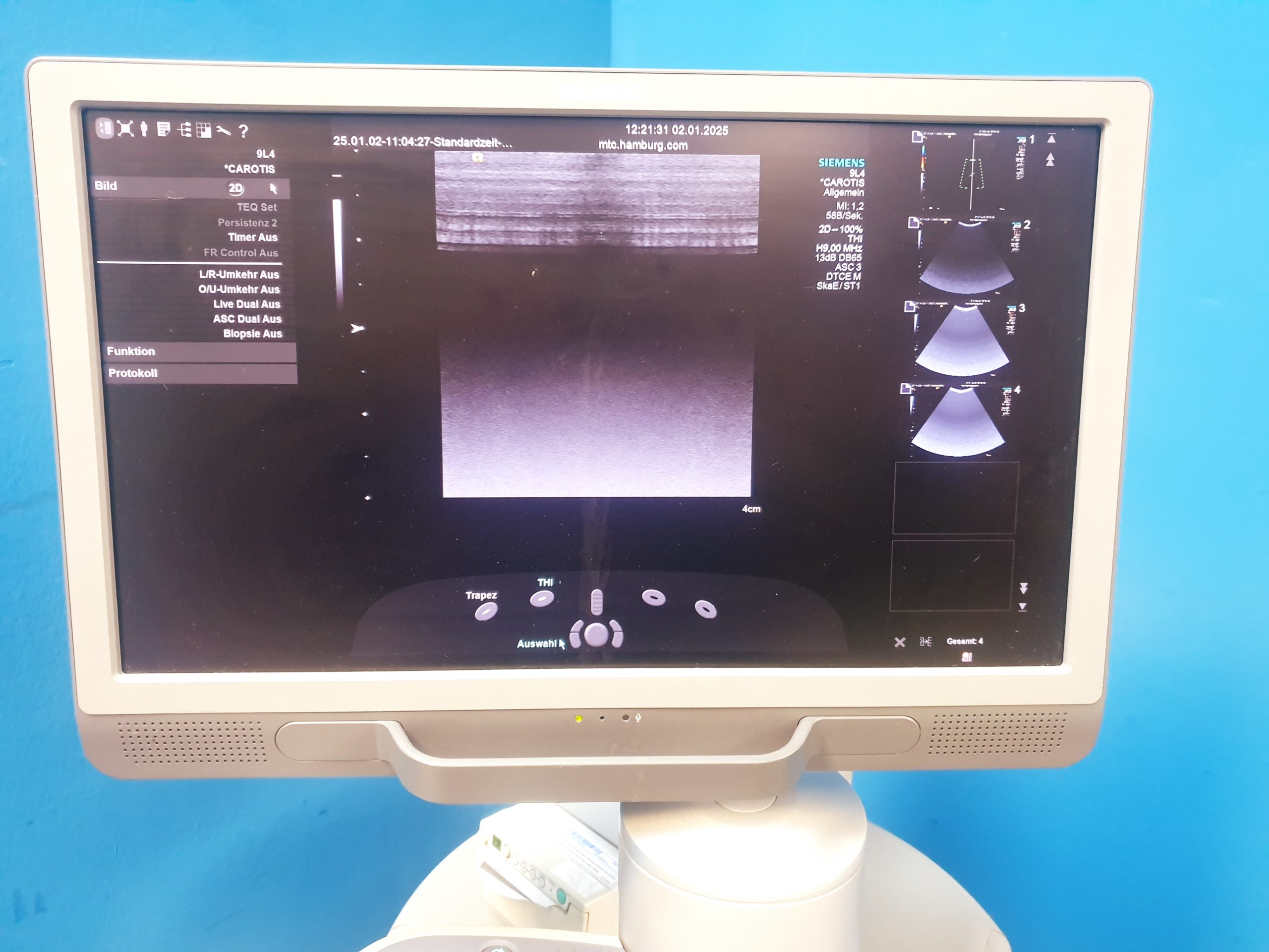 Siemens Acuson S2000 Doppler + 6C1HD + 4V1c Vector Array + 9L4 thumbnail 9